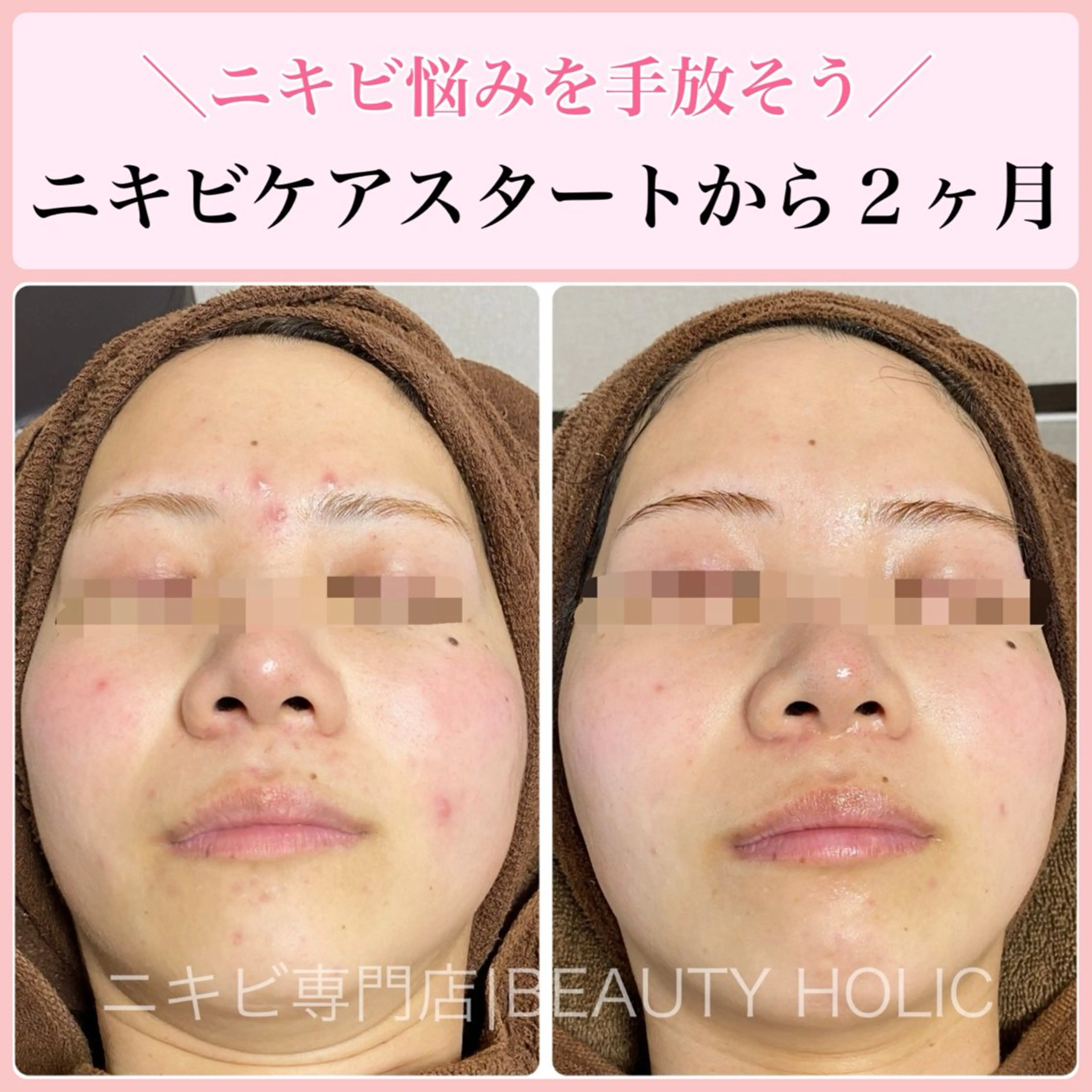 エステ リラク ニキビ・ 肌荒れ専門店のエステ・リラクイメージ