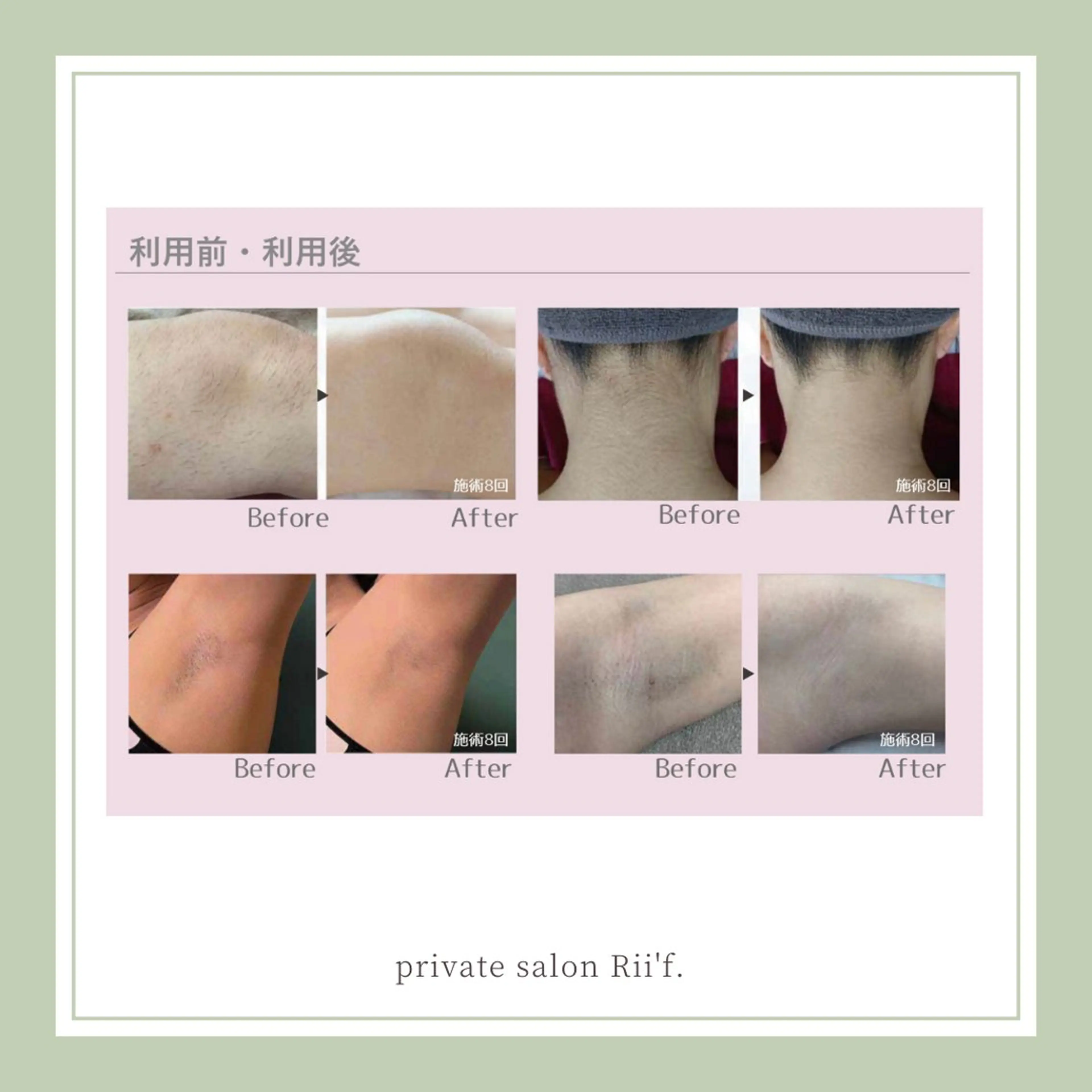 private salon Rii'f.所属・private sa lon Rii'f.のエステ・リラクイメージ
