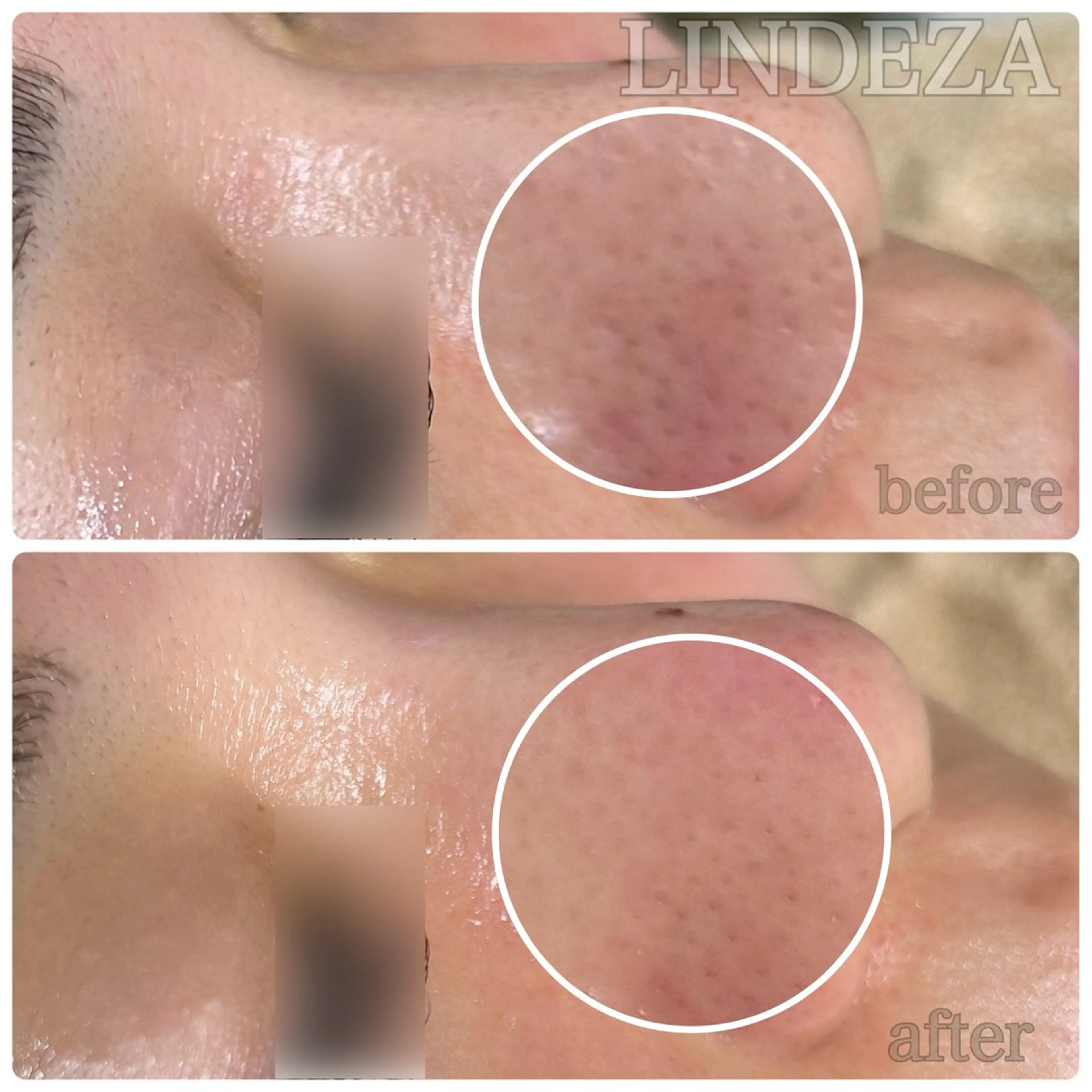 private salon 𝐋𝐈𝐍𝐃𝐄𝐙𝐀所属・LINDEZA Ayaのエステ・リラクイメージ