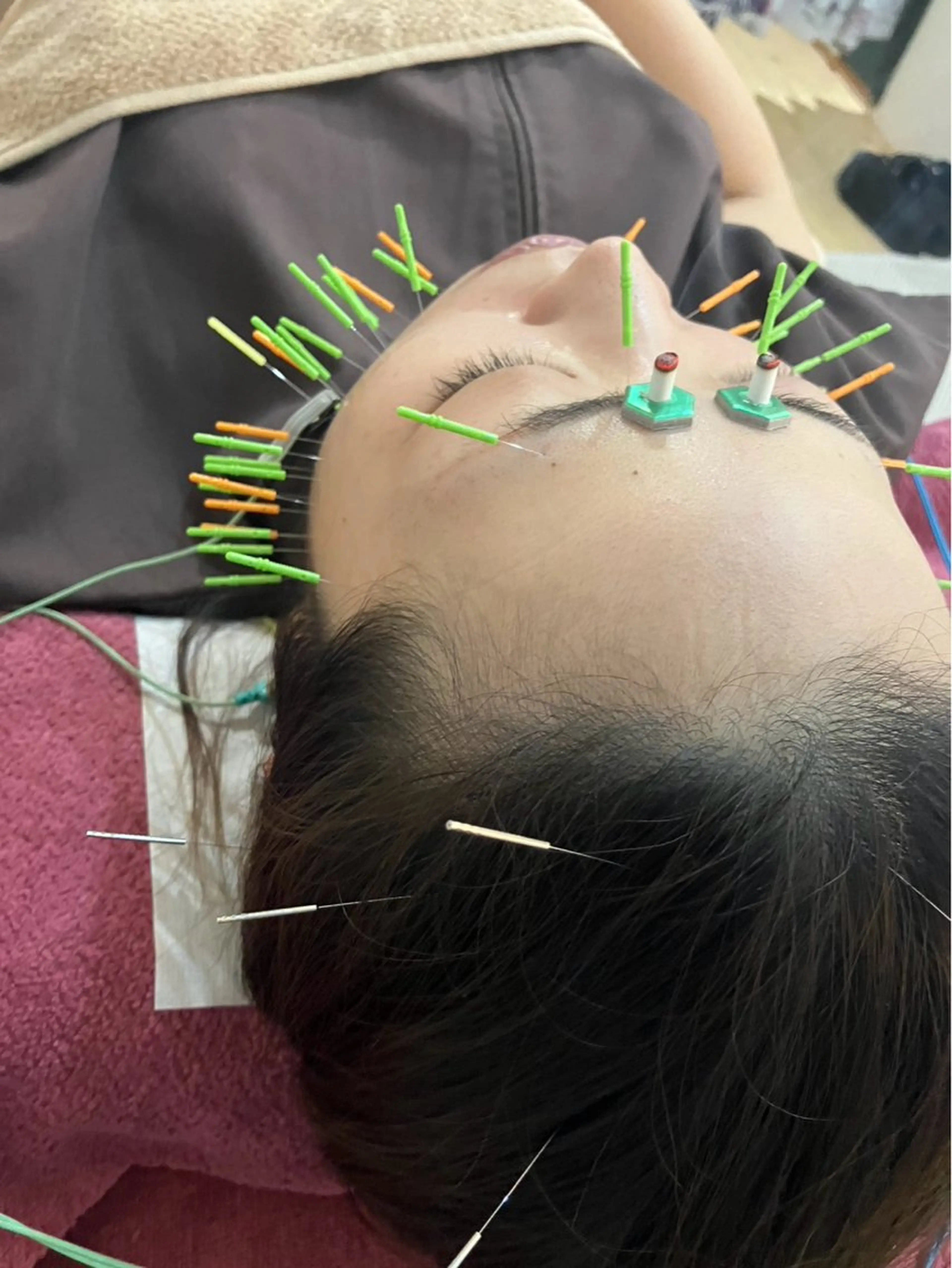 エステ リラク 美容鍼灸女性専用 りんご鍼灸治療院のエステ・リラクイメージ