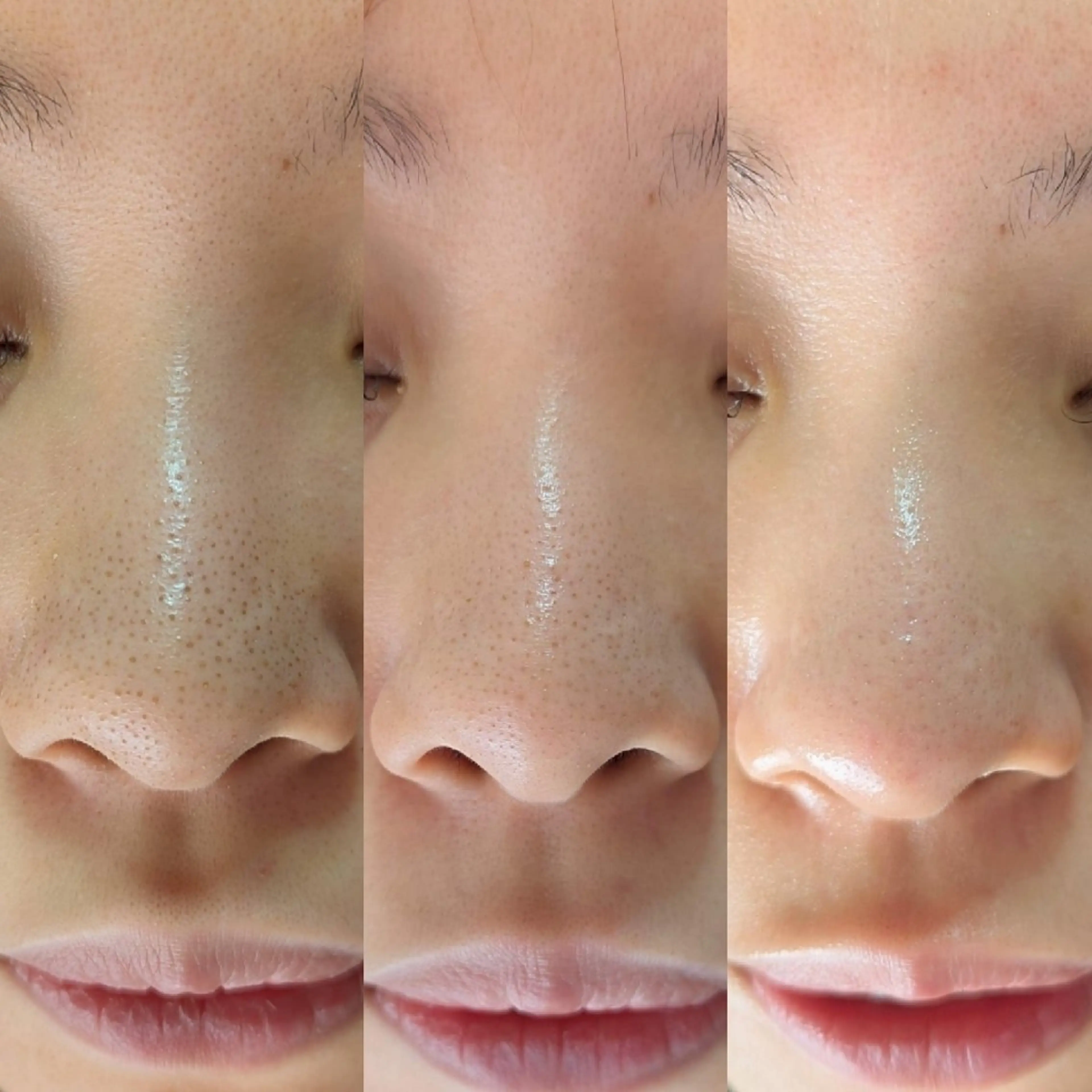 エステ リラク  毛穴洗浄・まつ毛 の専門店 ソラーレのエステ・リラクイメージ