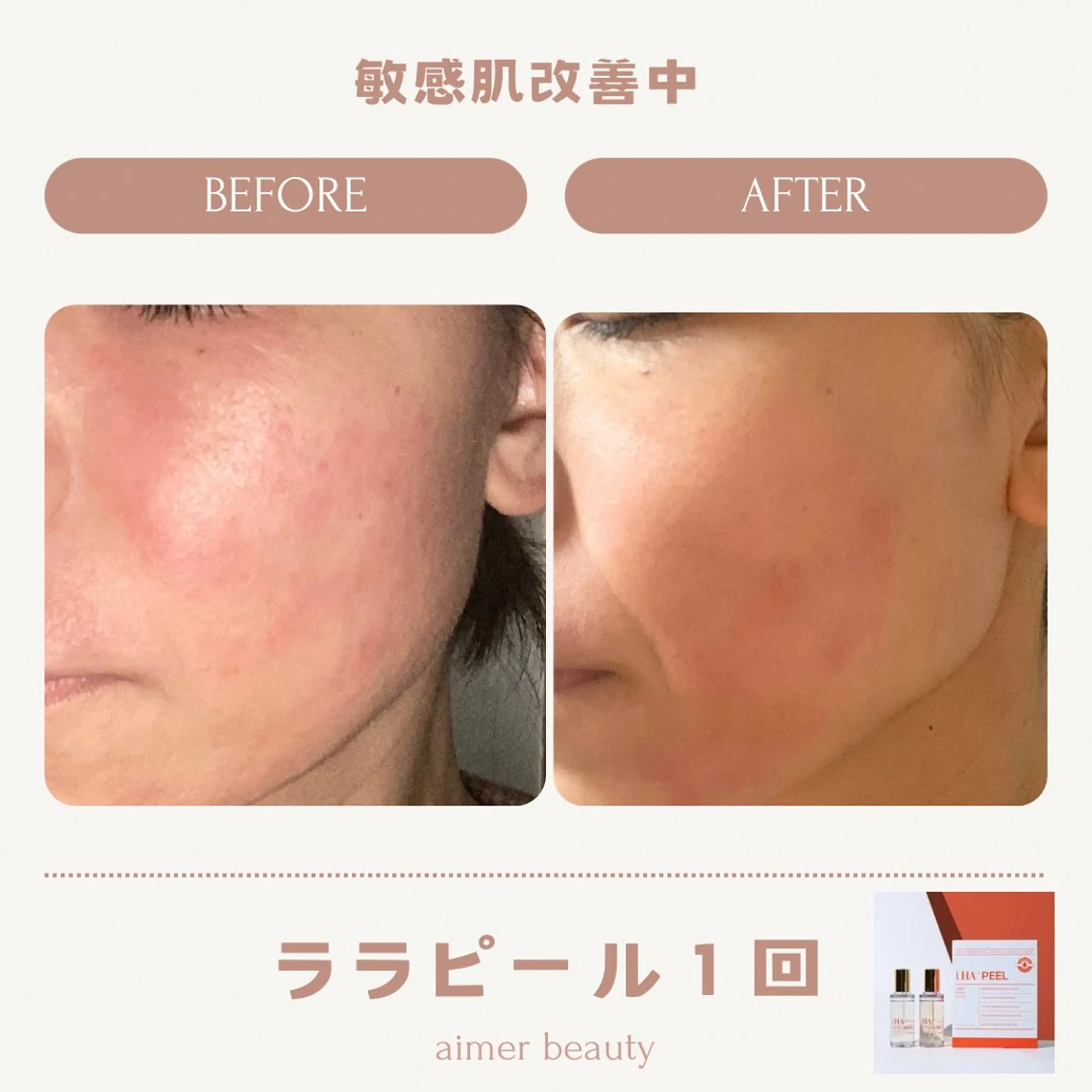 エステ aimer beautyのエステ・リラクイメージ