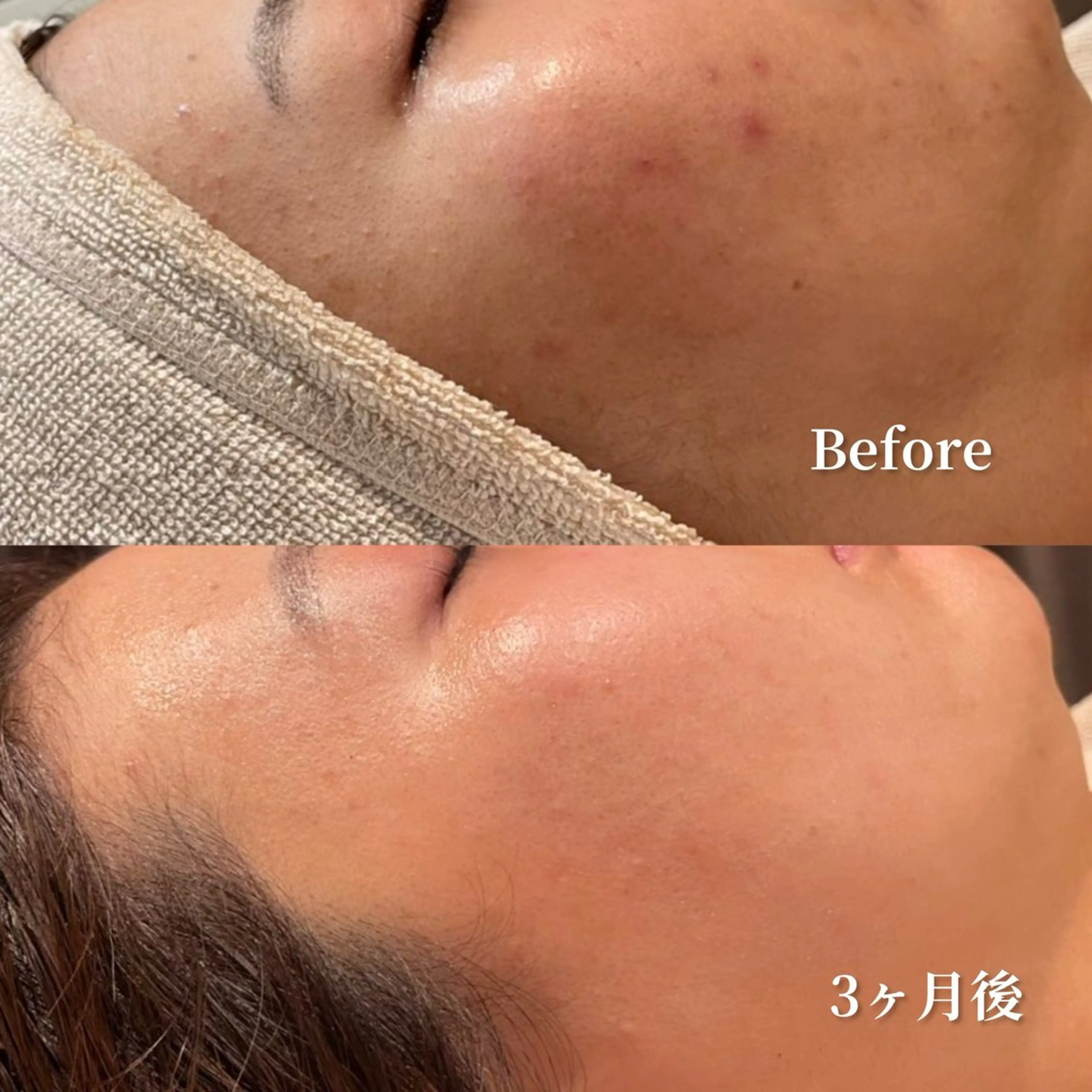 エステ /ulu  soin所属・太田 玲奈のエステ・リラクイメージ