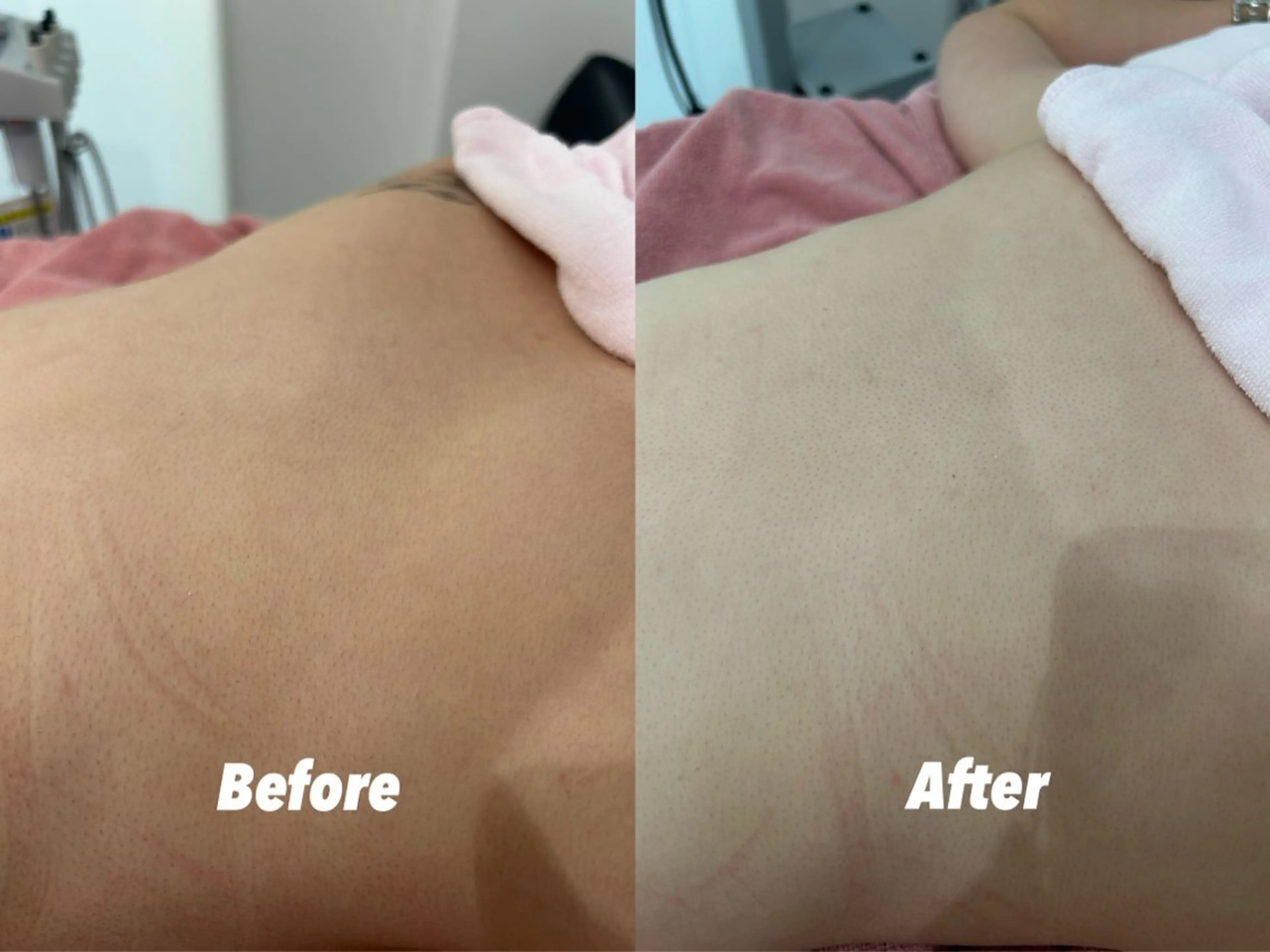 エステ リラク 🫧美しい素肌へ🫧 今成柚乃のその他イメージ