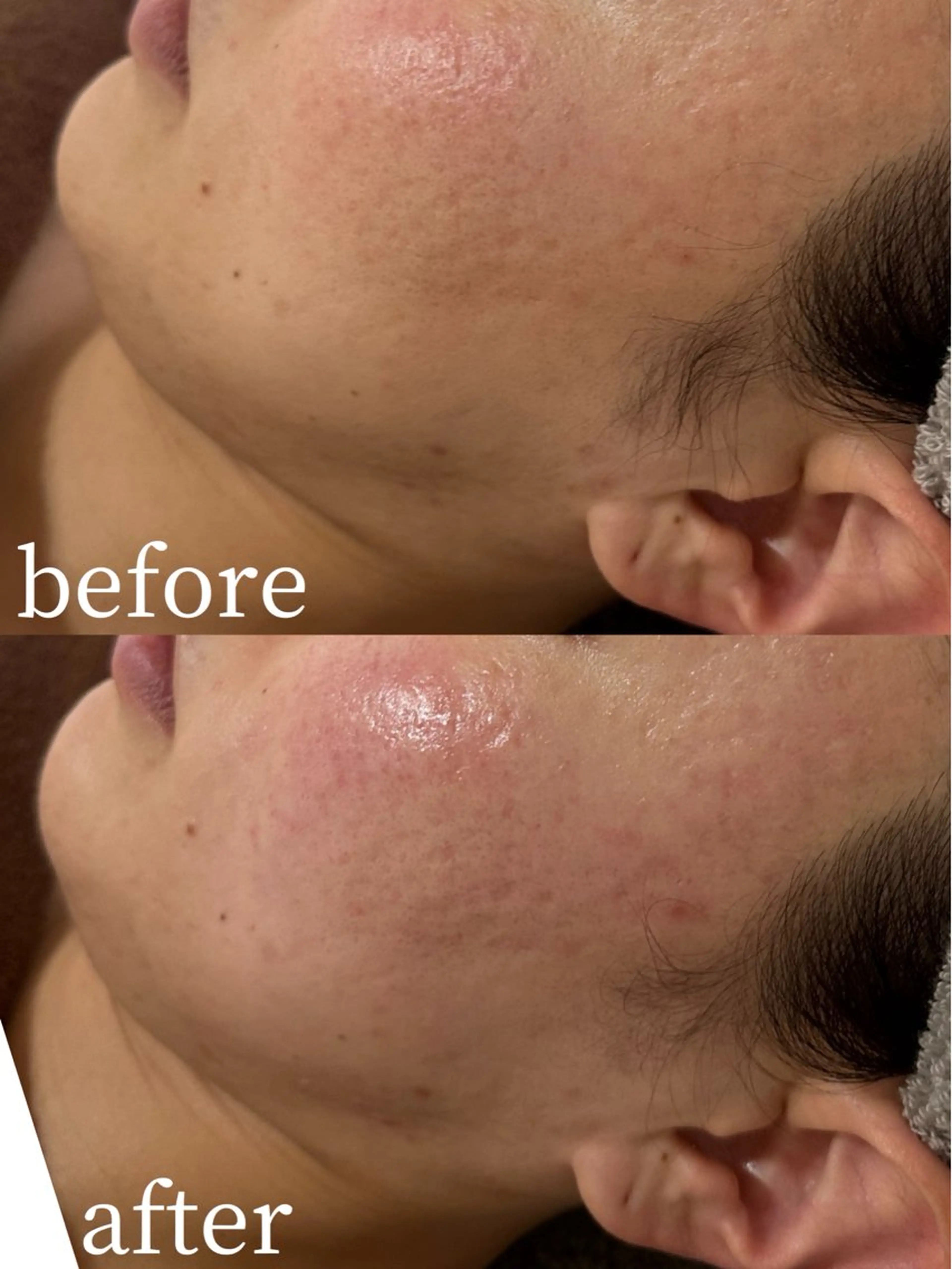 La forepos 恵比寿所属・La forepos フェイシャルエステのエステ・リラクイメージ