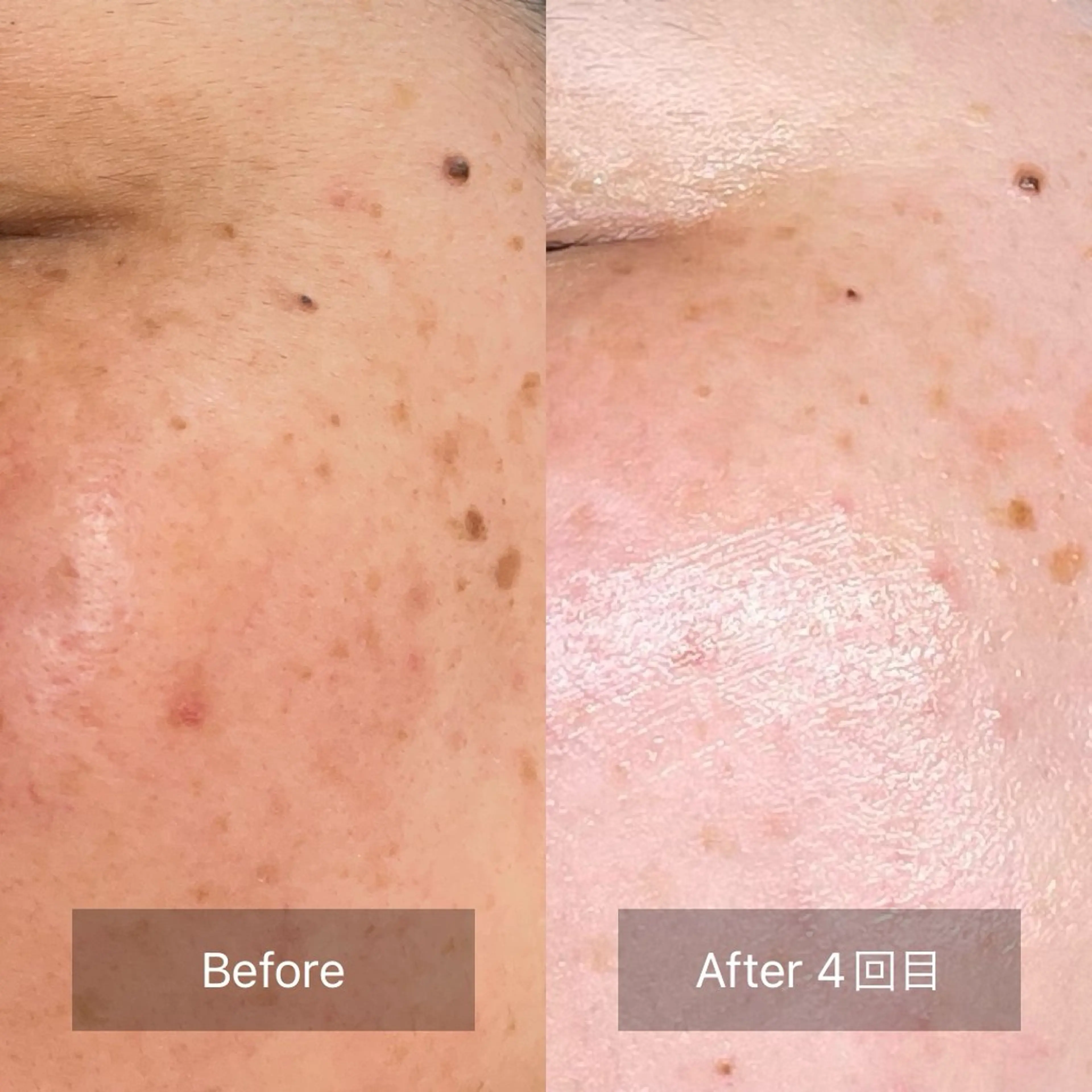 loa まつ毛と肌管理のお店のマツエク・マツパデザイン