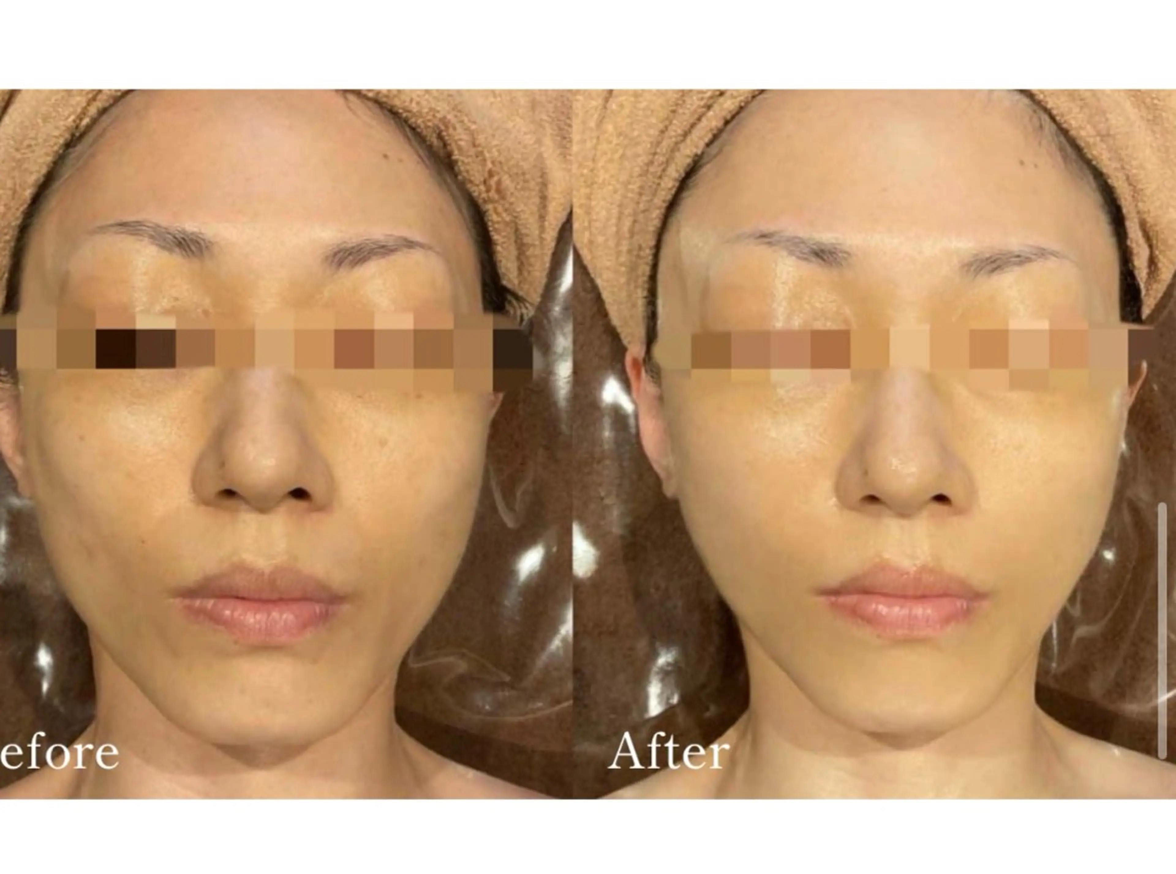 Total Beauty salon Bloom所属・肌育WISHpro 専門サロンBloomのエステ・リラクイメージ