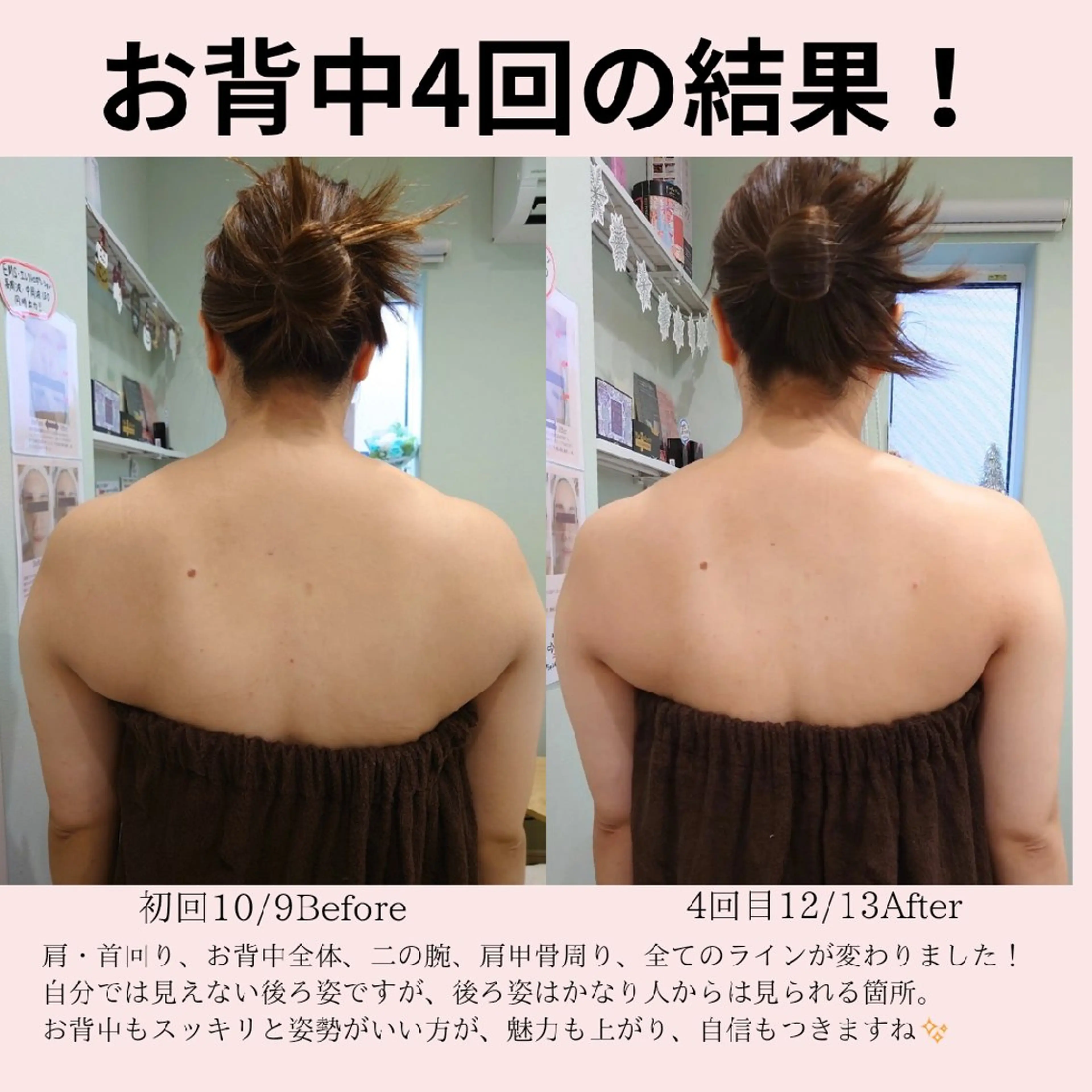 エステ PRETTIEST SHINE所属・山田 浩子のエステ・リラクイメージ