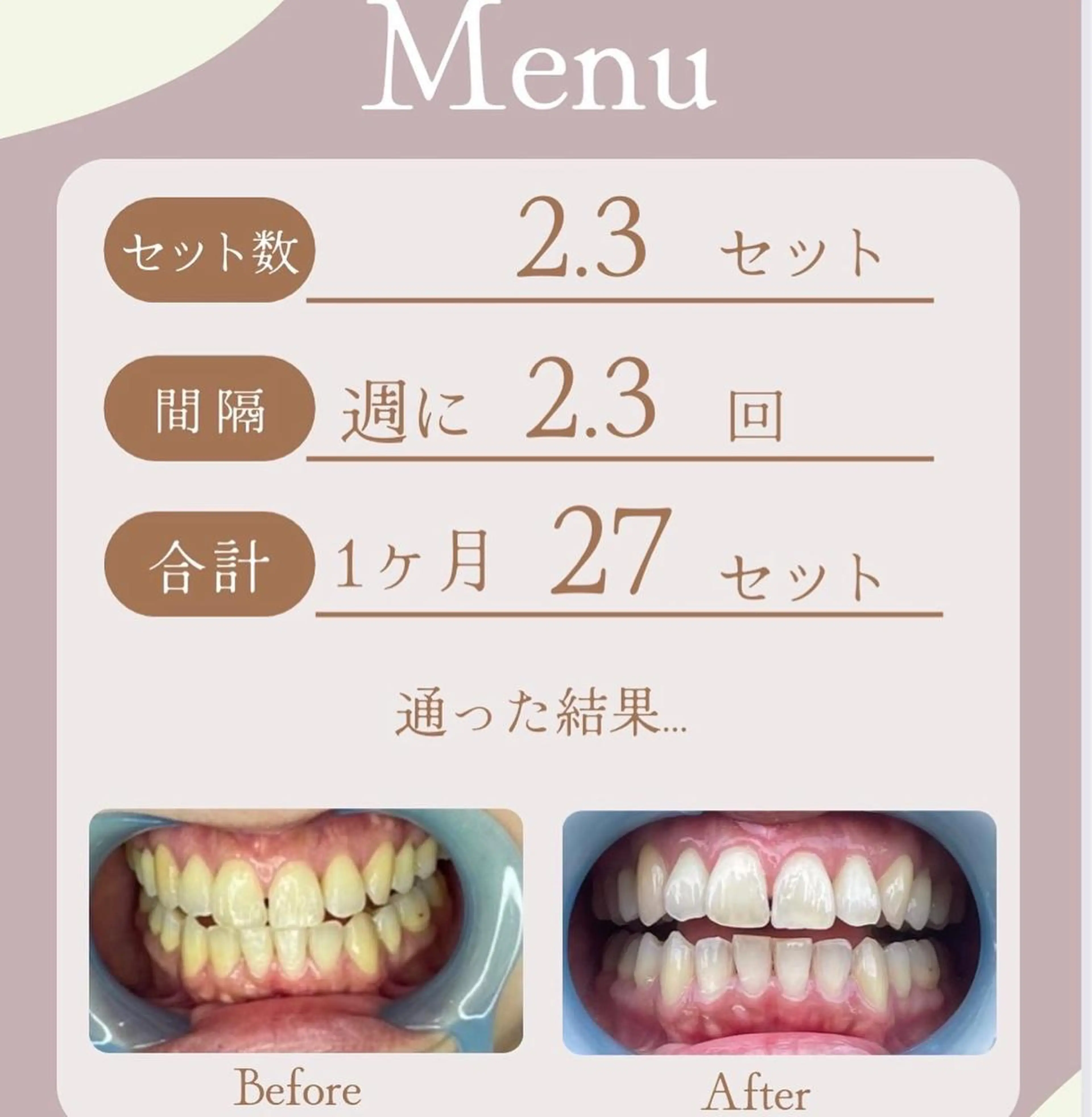 LAVISH nail salonのネイルデザイン