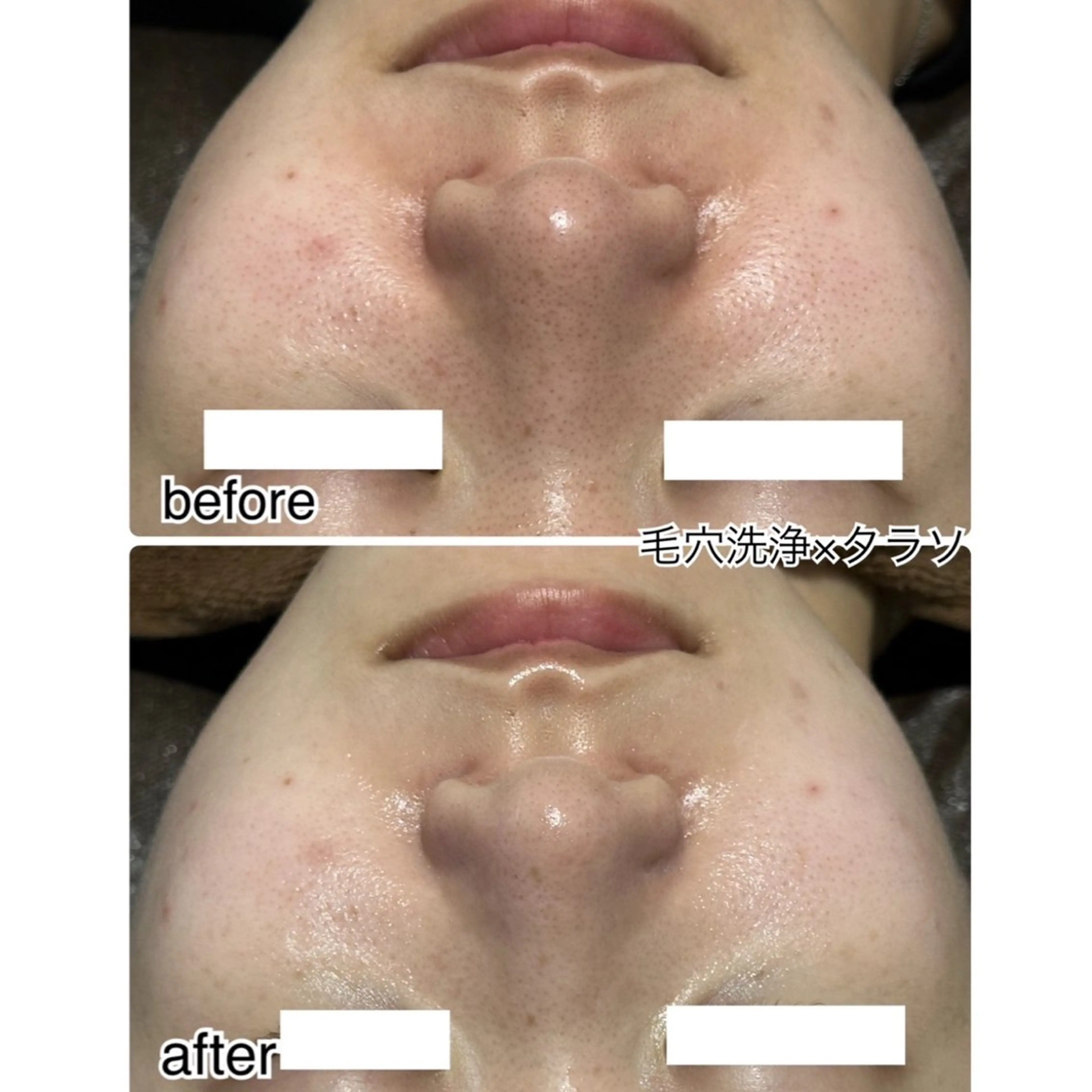 エステ kamie suzuneの眉毛・アイブロウイメージ