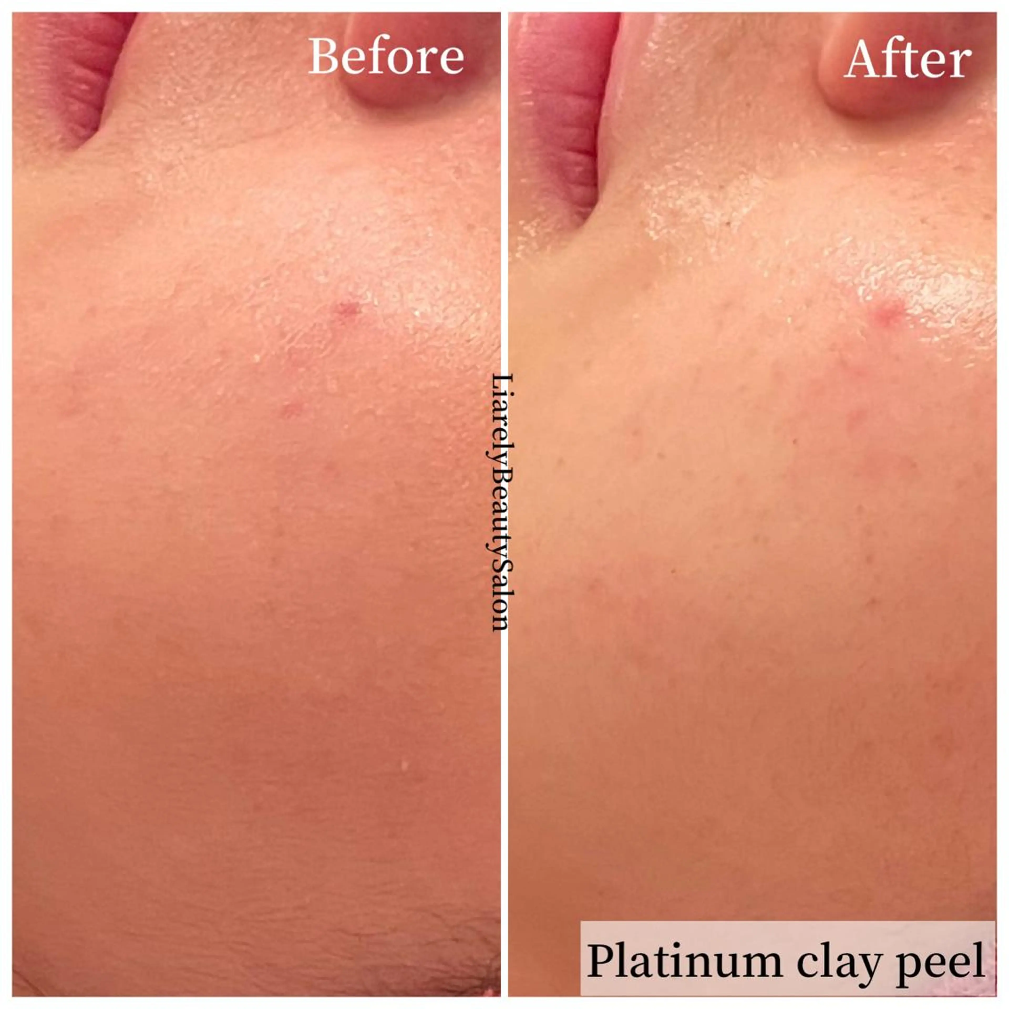 リアレリー 🪞🌹Ryokoのエステ・リラクイメージ