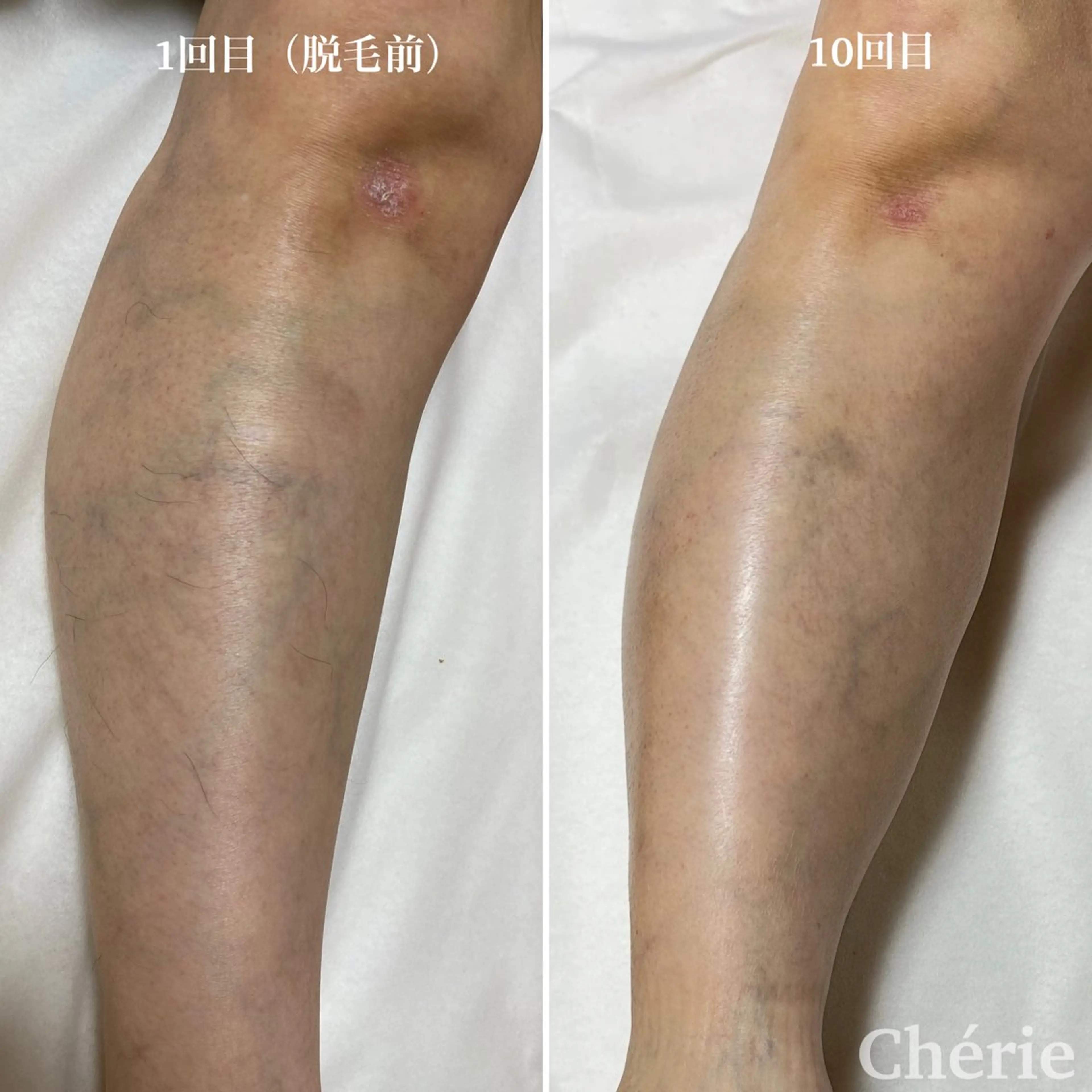 大津 香（シェリー）のエステ・リラクイメージ