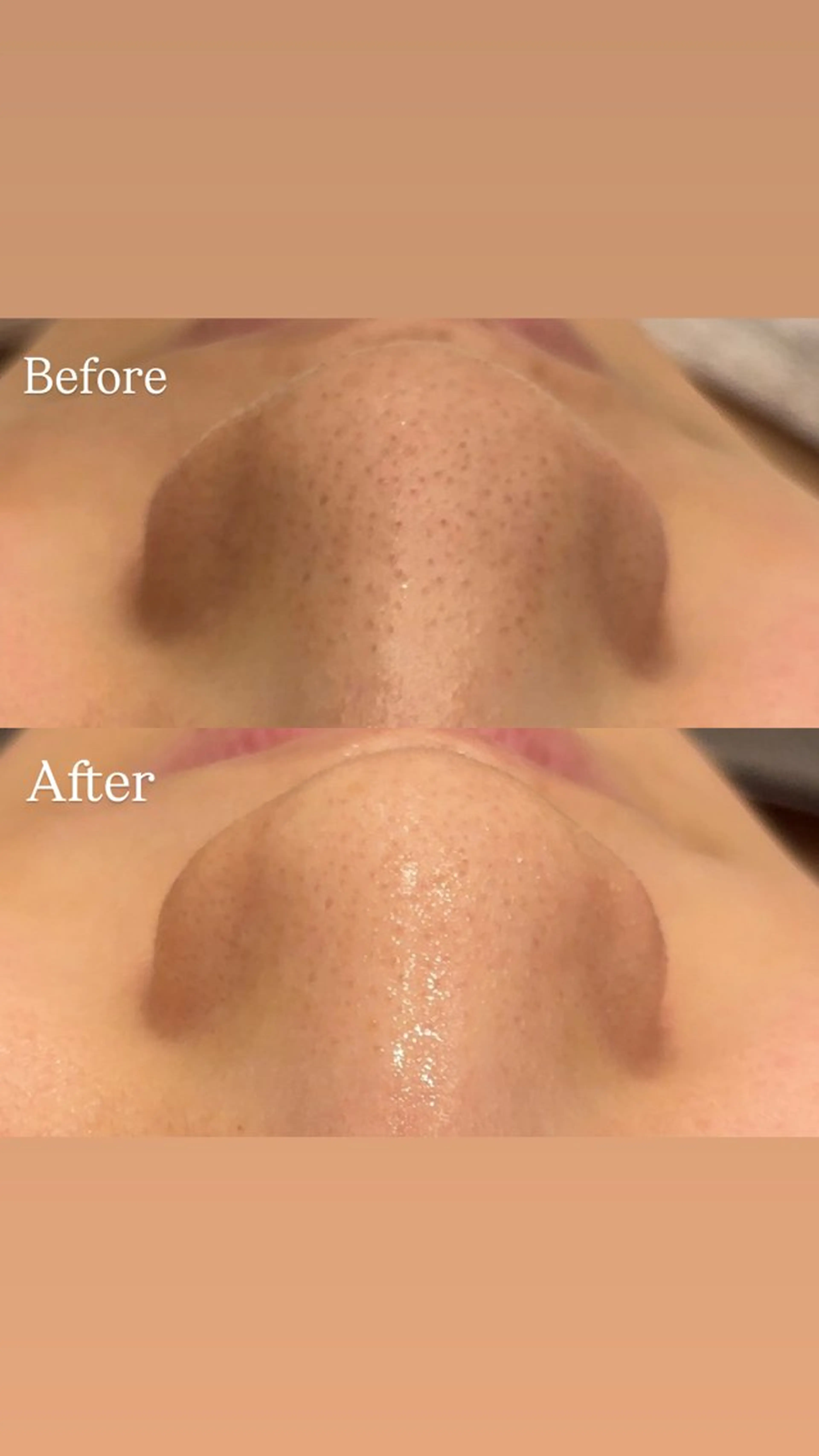 Hari Lounge恵比寿所属・chika🦋 ハリラウンジ恵比寿のエステ・リラクイメージ