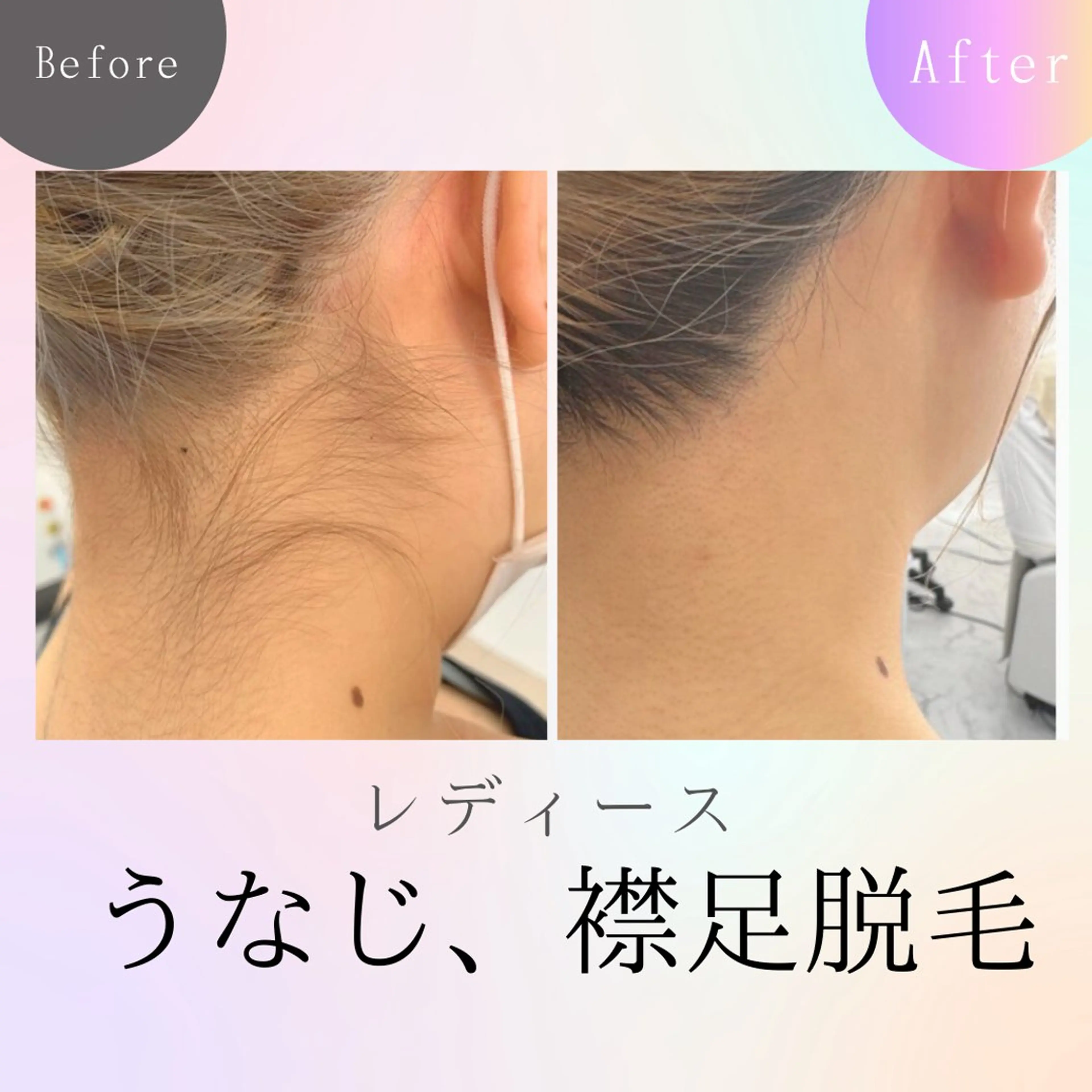 メンズ キッズ 脱毛 エステサロンさら所属・エステサロン さらのエステ・リラクイメージ