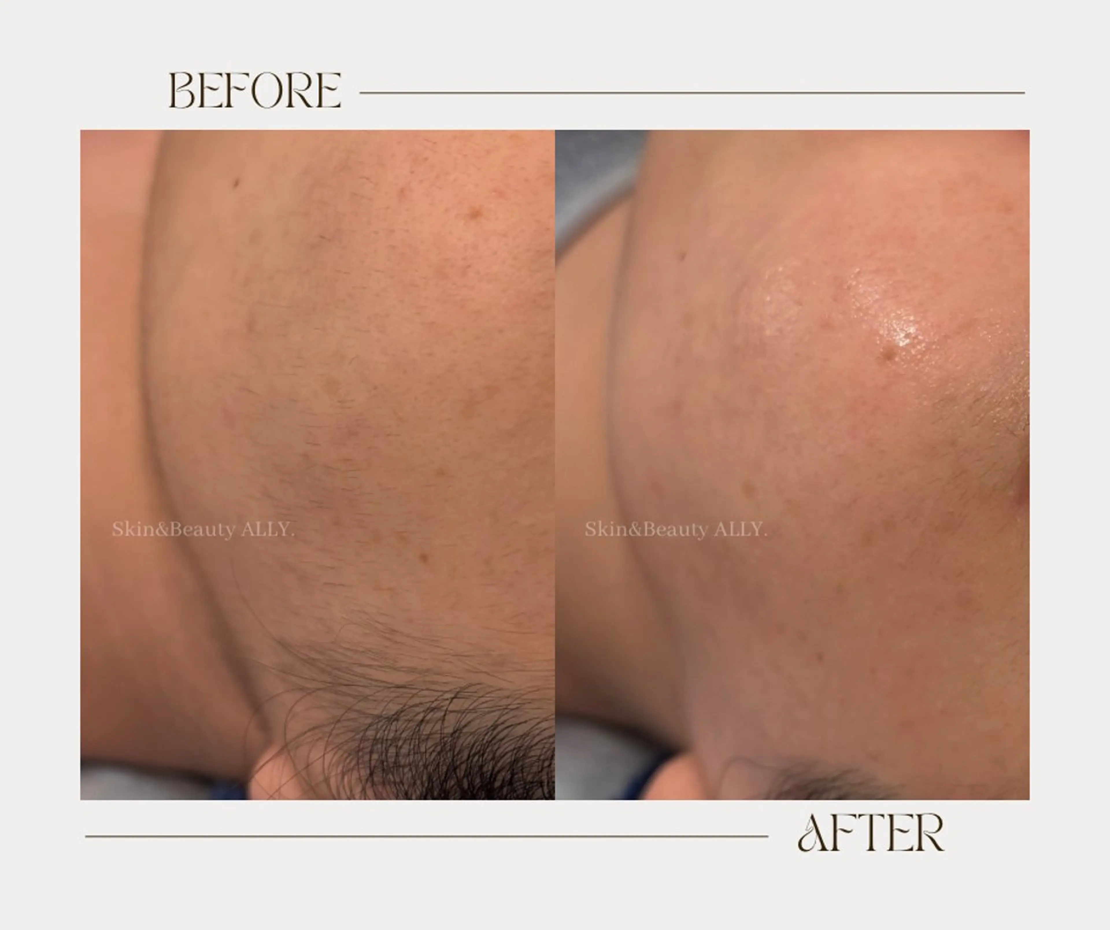 その他 艶肌ワックス ALLY.のエステ・リラクイメージ