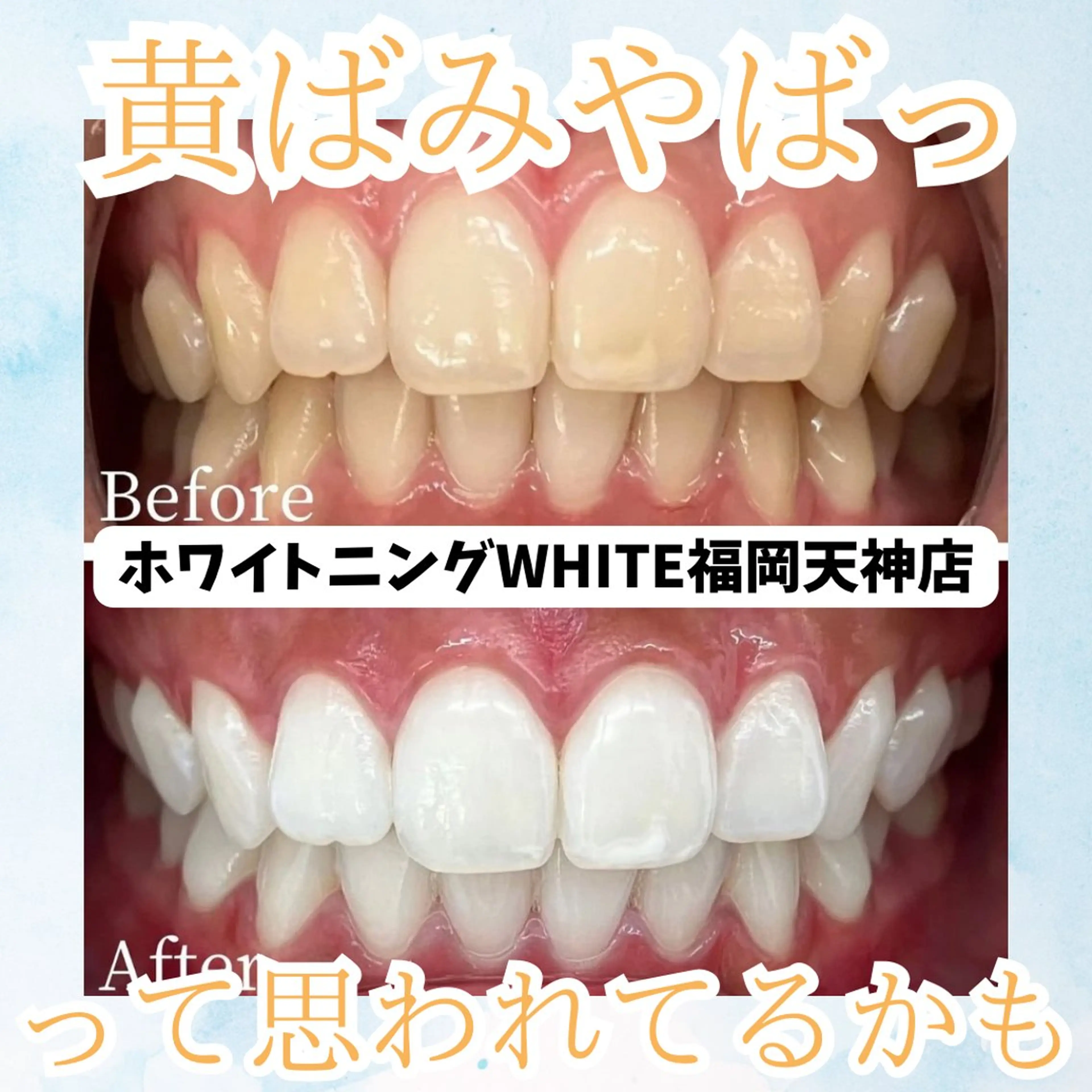 メンズ エステ リラク ホワイトニング専門店 WHITE天神店のエステ・リラクイメージ