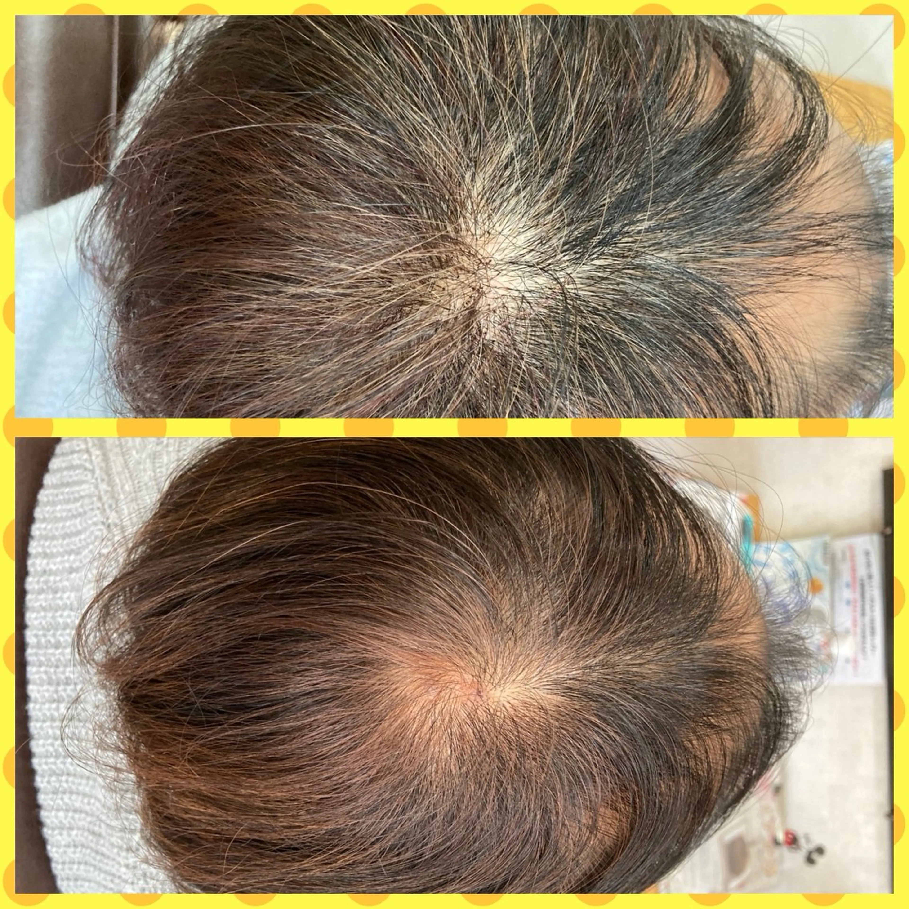 ミディアム エクステ Be Bell（ビベル）所属・プライベートサロン 【Be Bell】のマツエク・マツパデザイン