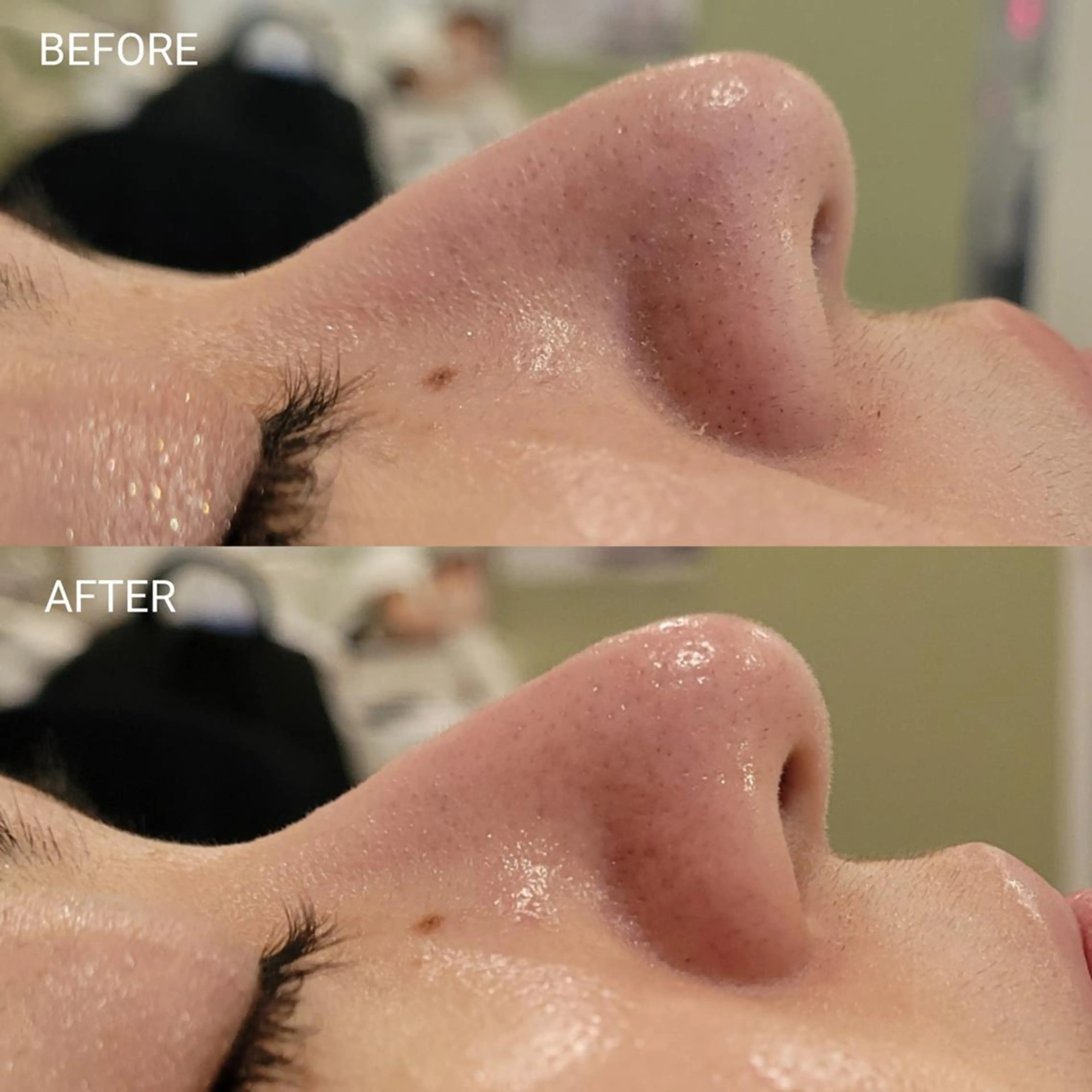 エステ リラク サロンドフララ 表参道店のエステ・リラクイメージ