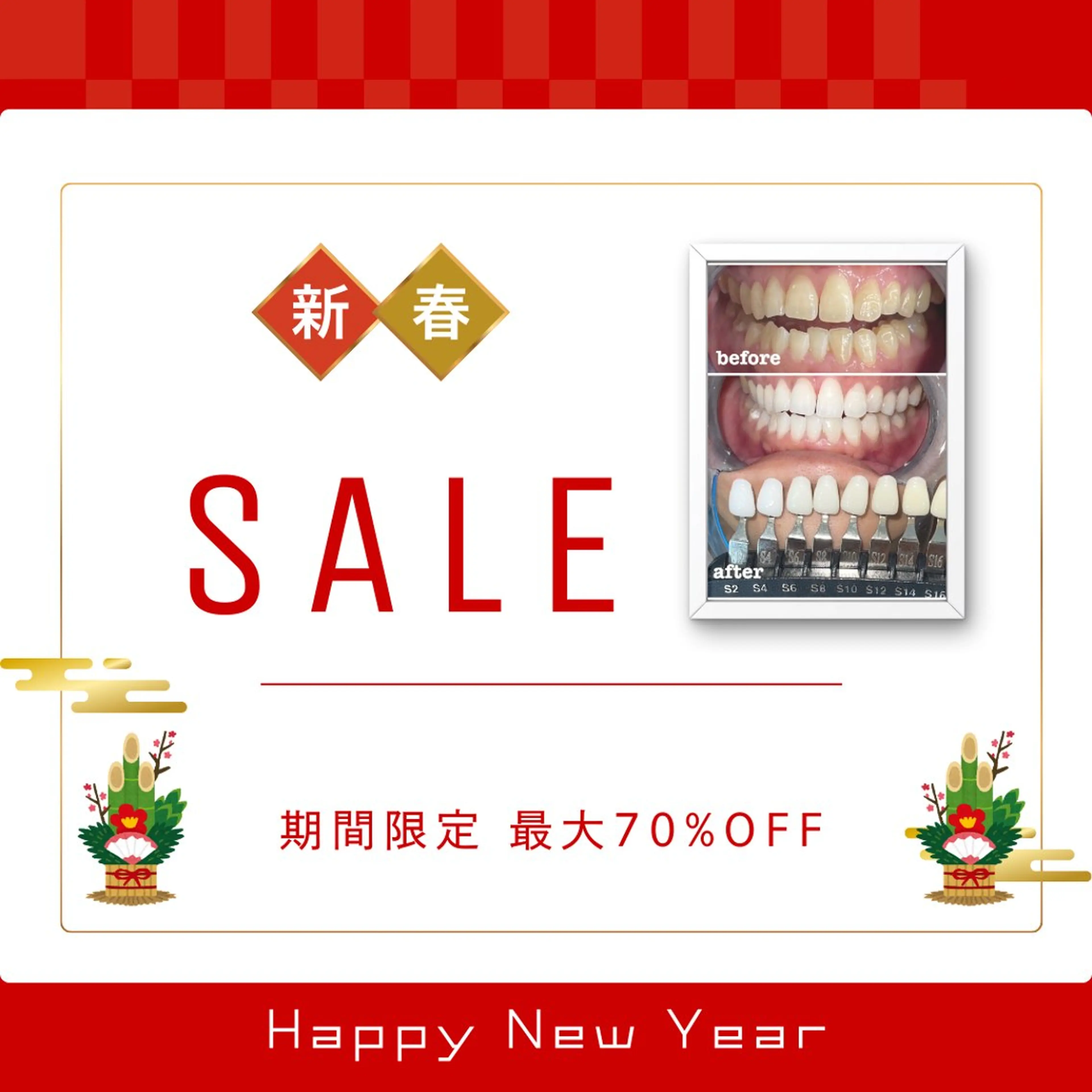 ホワイトニング/脱毛 専門店エクシア岡崎店のその他イメージ