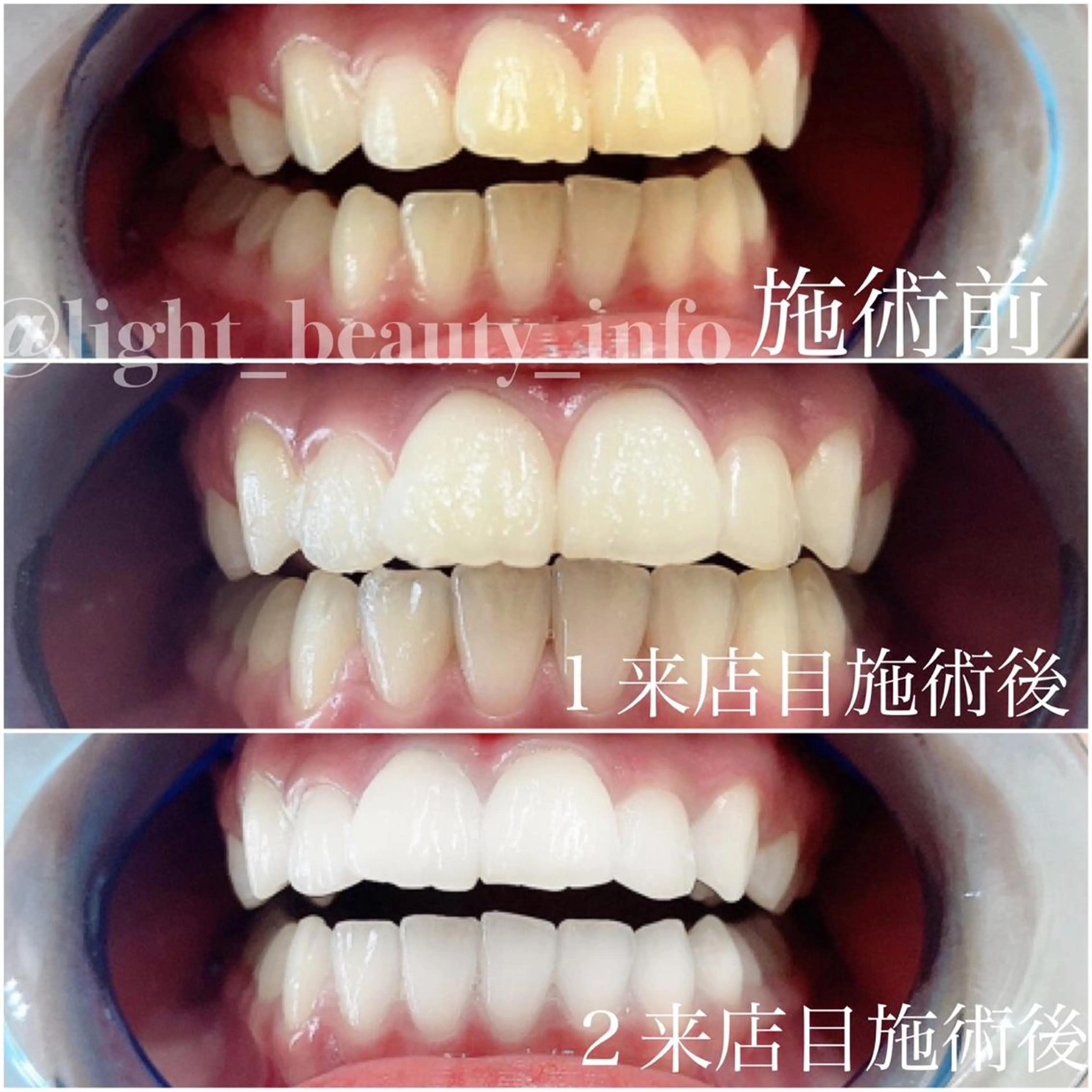 エステ リラク ライトビューティー 銀座本店のエステ・リラクイメージ