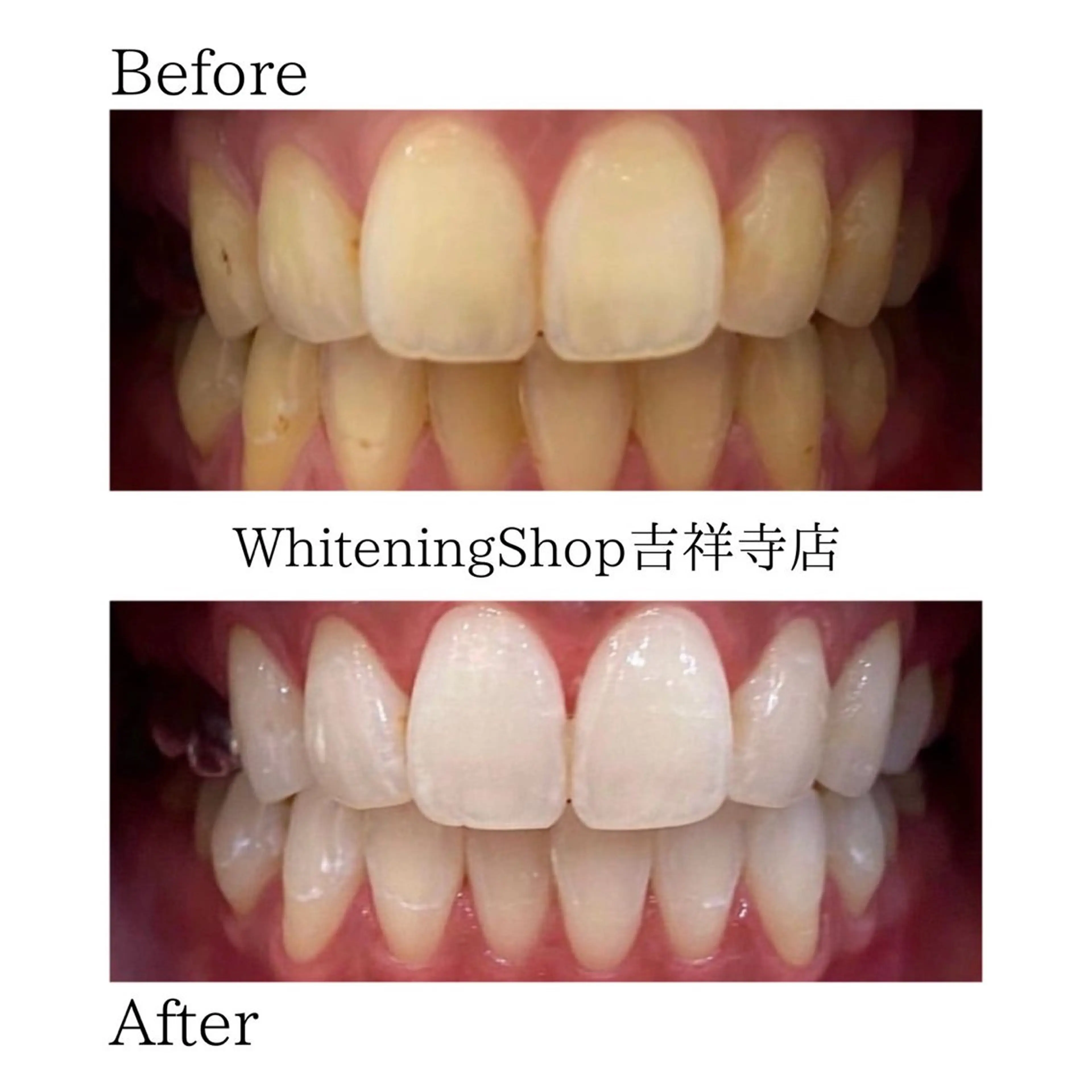 エステ リラク ホワイトニング ショップ吉祥寺店のエステ・リラクイメージ