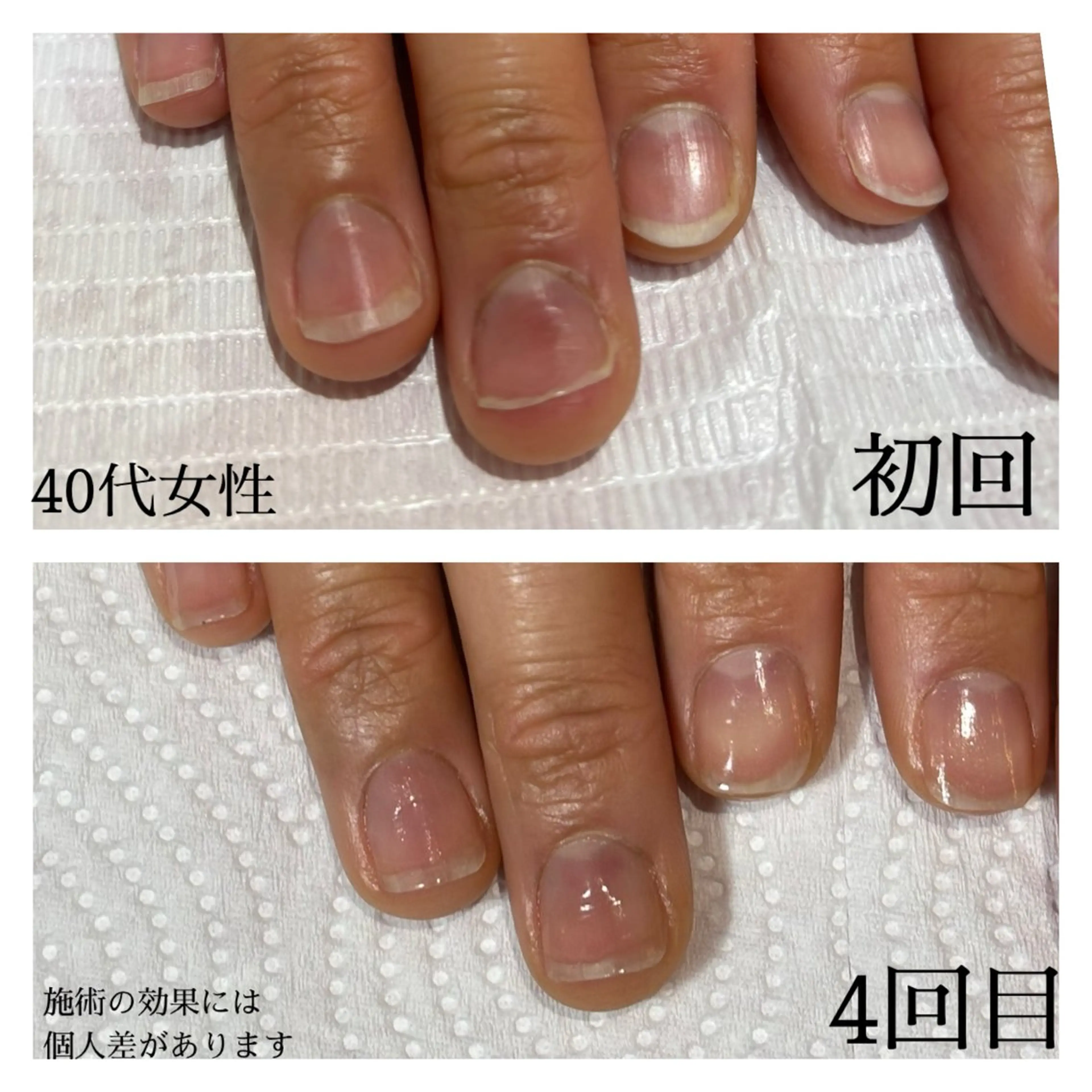 ネイル 自爪育成専門サロン エムロードゥ池下のネイルデザイン