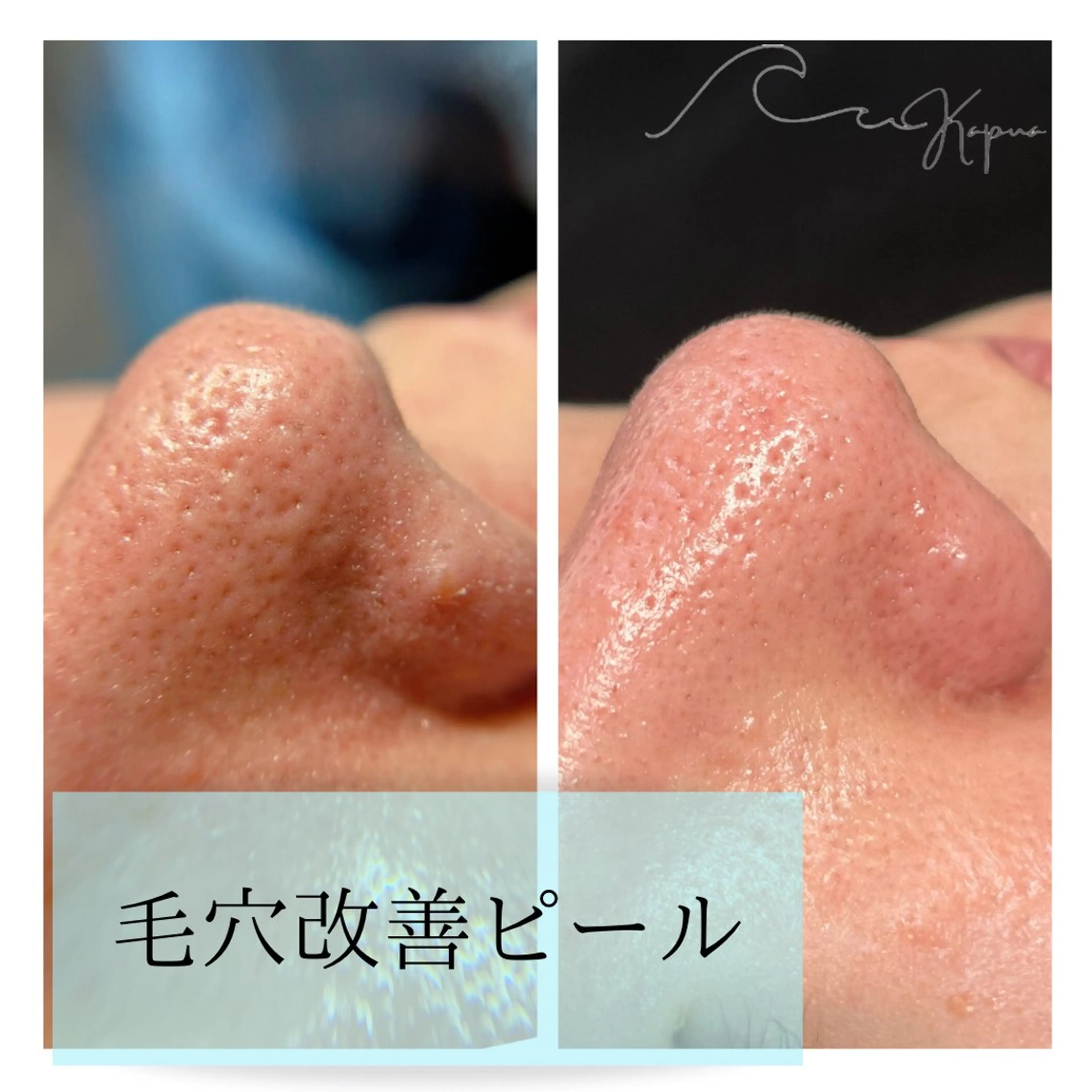 エステ kapua所属・Kapua🌺 マユのマツエク・マツパデザイン