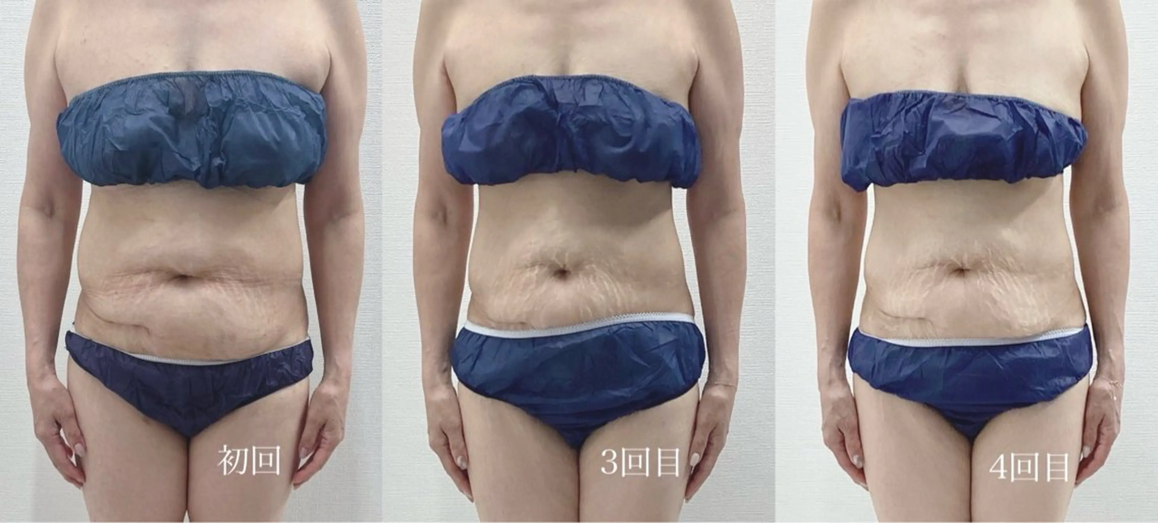 エステ Genesis Plus大津京店のエステ・リラクイメージ