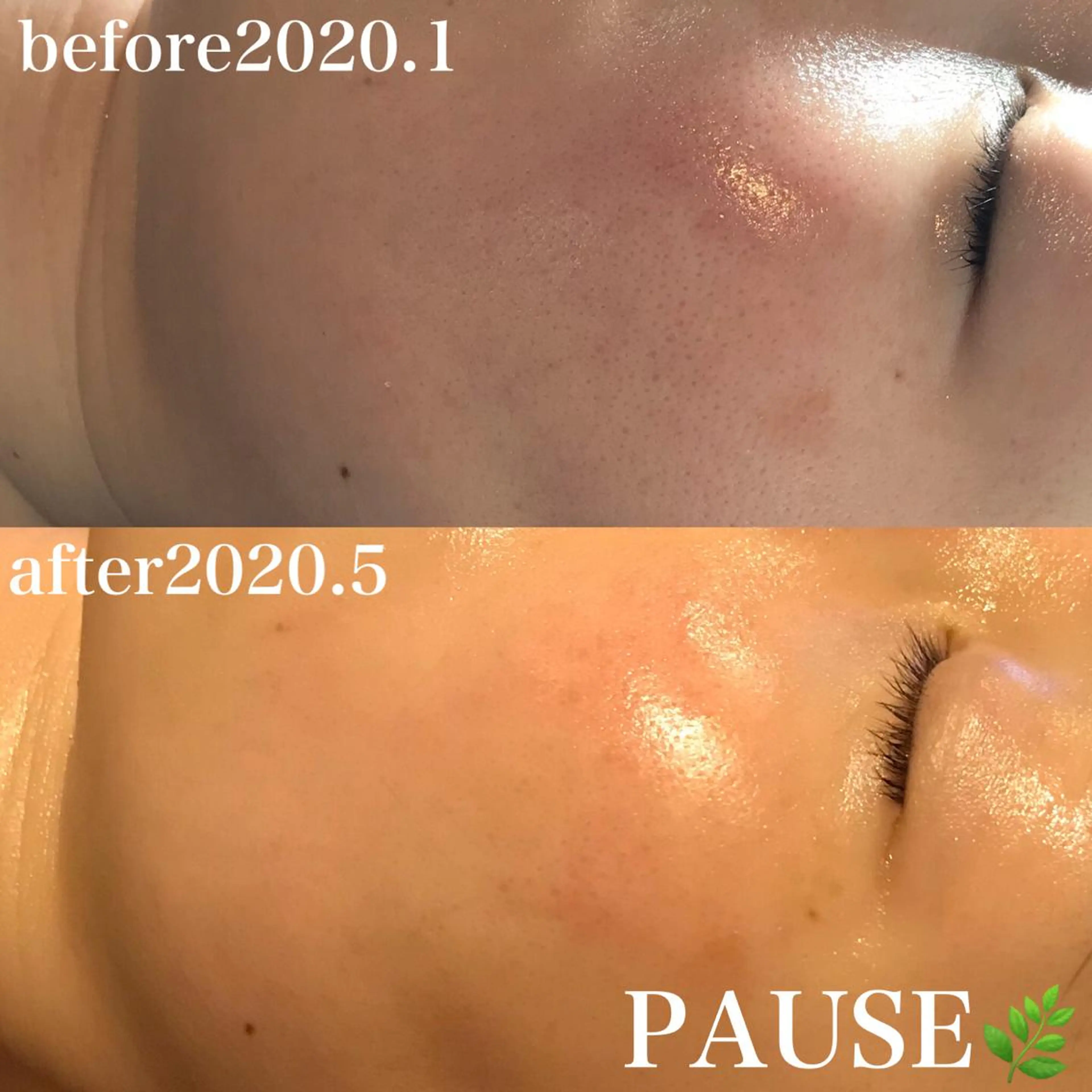 エステ 浜野 恵美のエステ・リラクイメージ