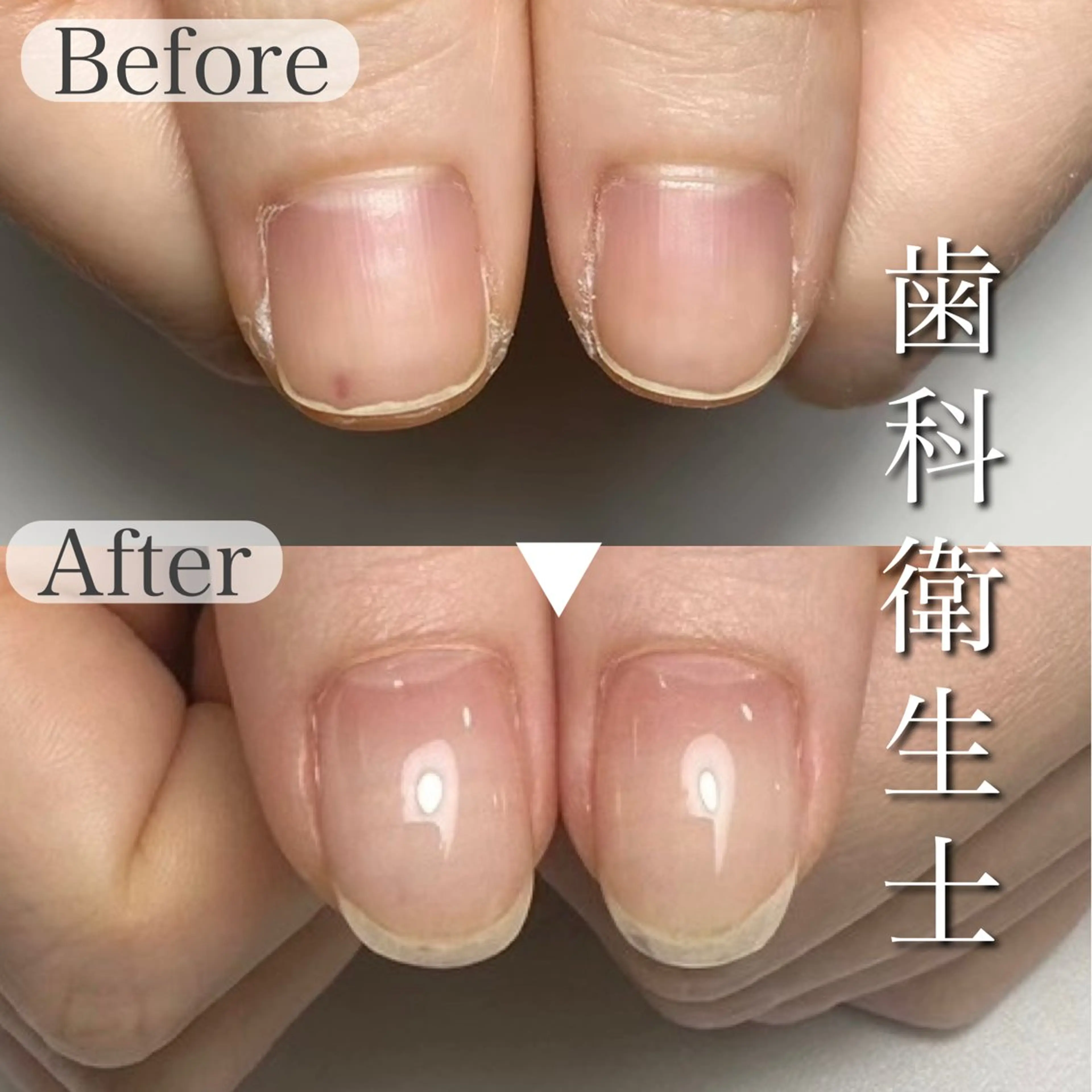 ネイル 深爪専門店 サロンリリーのネイルデザイン