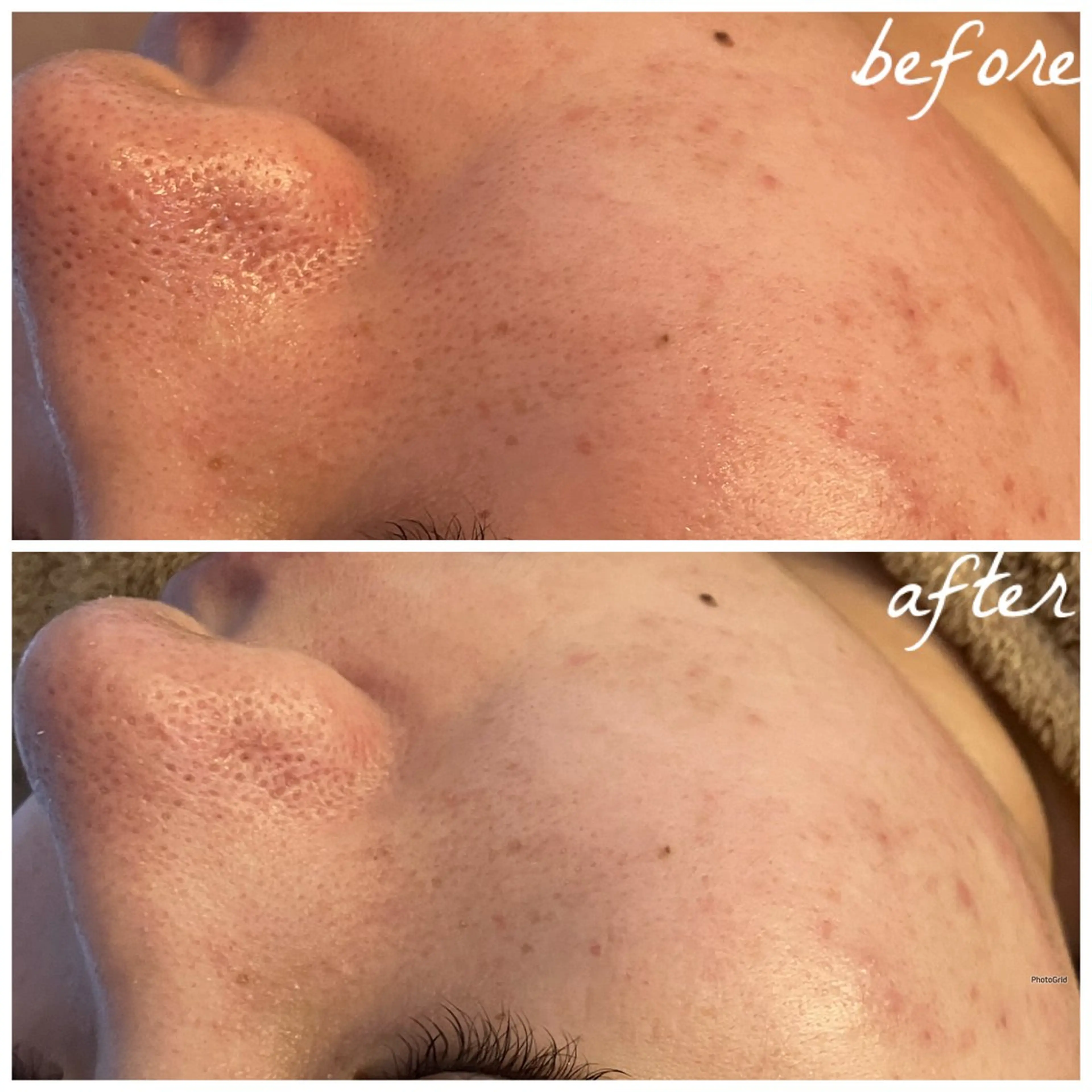 メンズ メナード岐阜茜部 杉浦のエステ・リラクイメージ