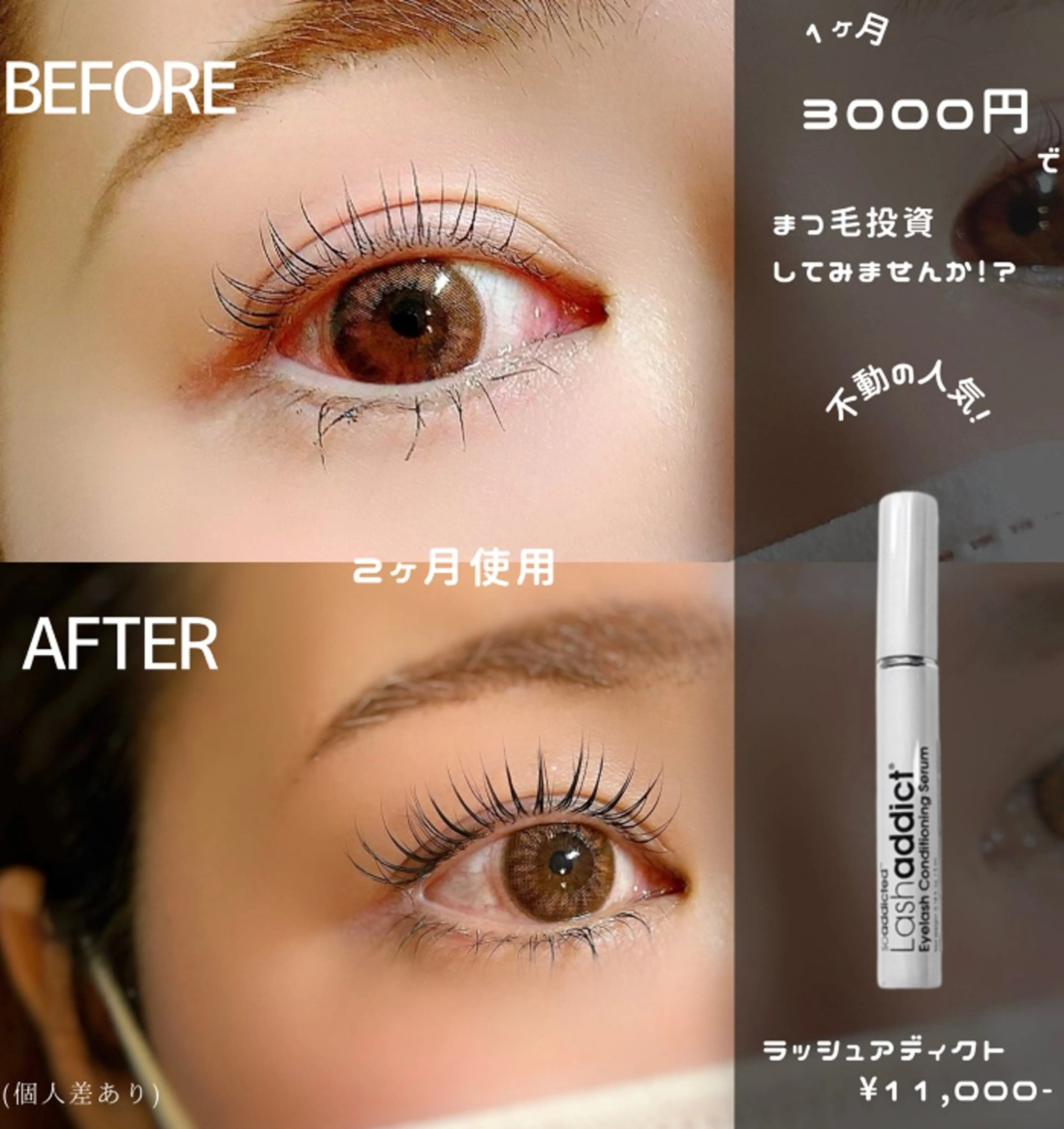 人気NO.1美容液☝🏻 ̖́-ラッシュアディクト× 選べるパーマsetクーポン🌝🪄︎︎の写真