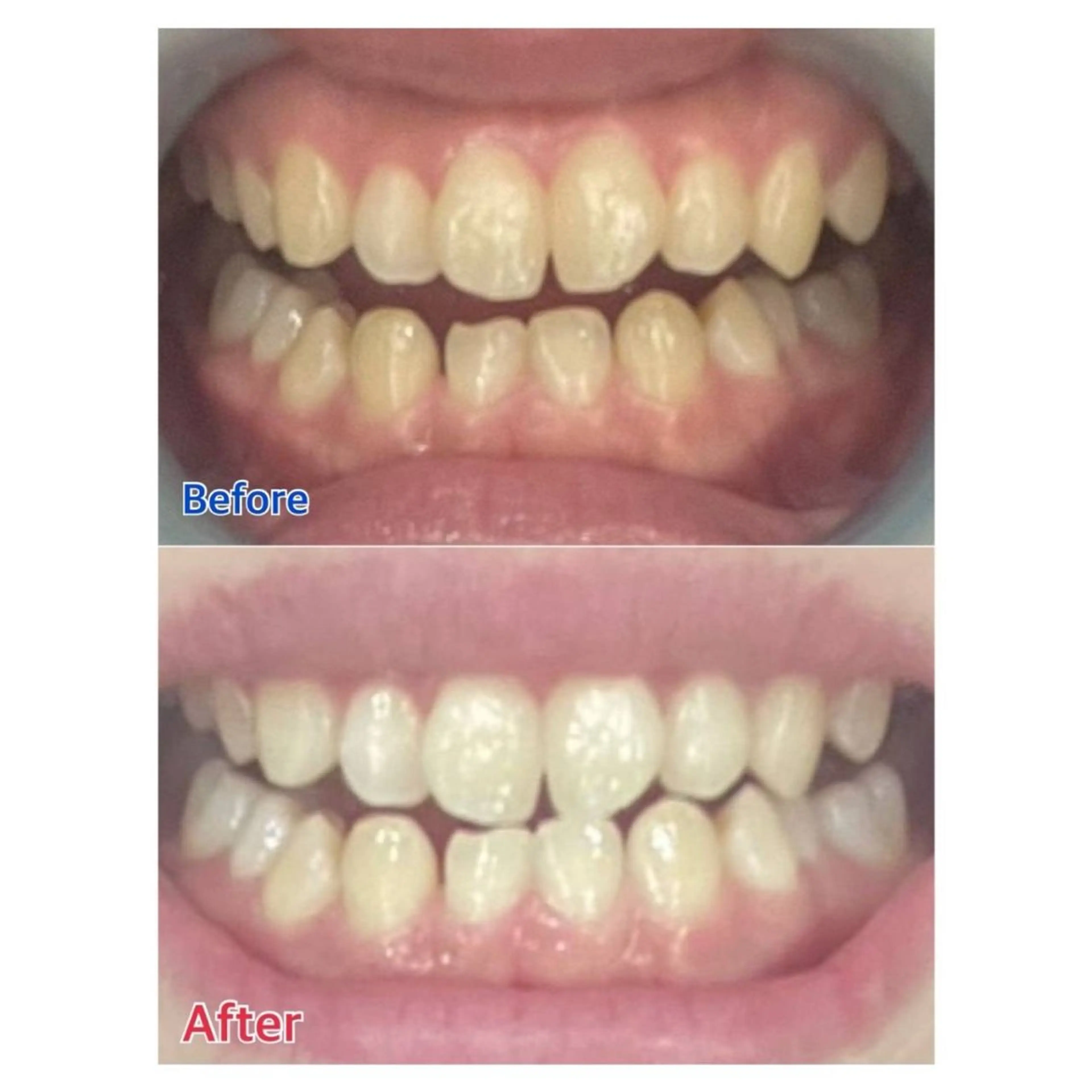 MBEAUTYSALON 千葉店・京成大久保所属・Melty 輝のその他イメージ