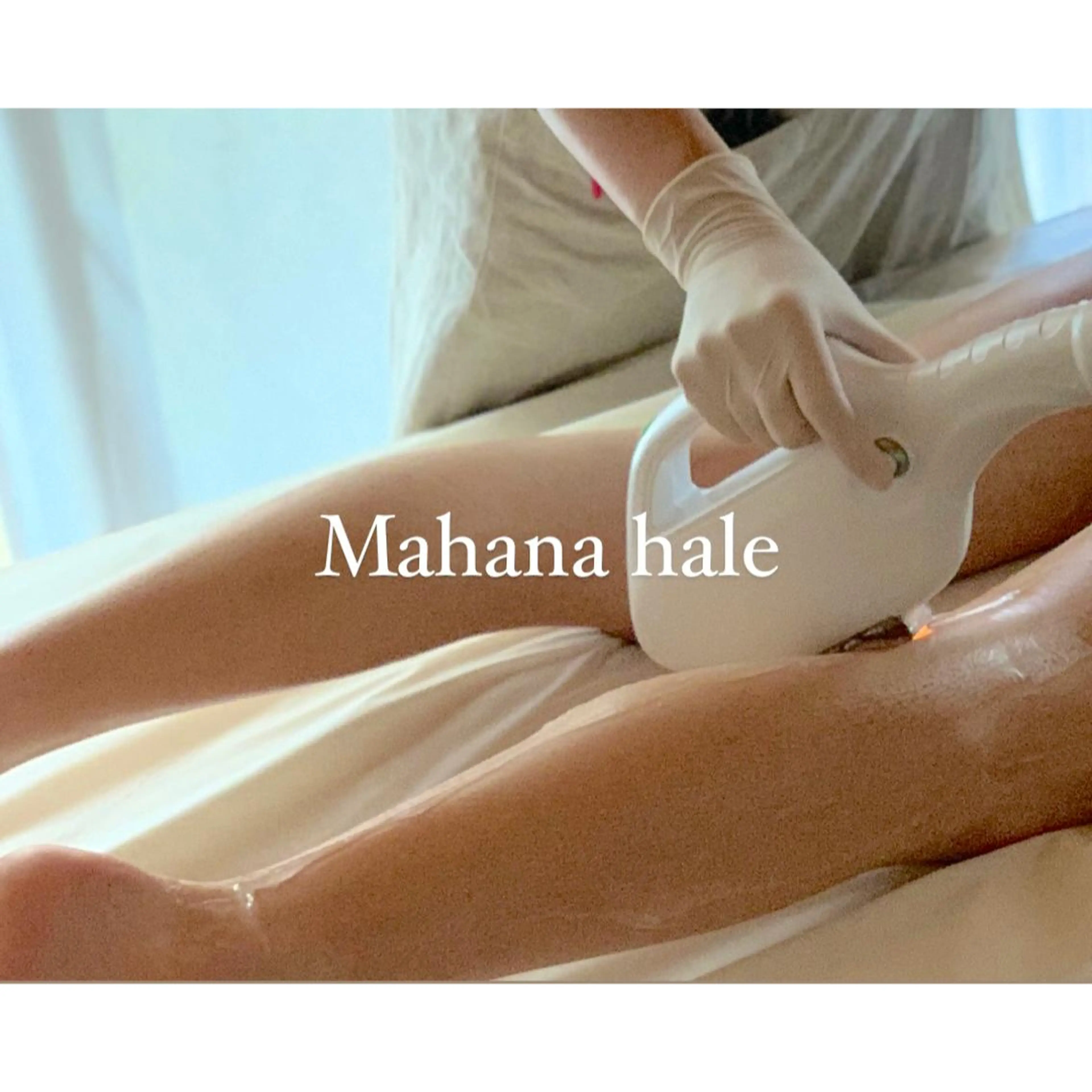 【光脱毛】 Lパーツ(胸全体、お腹全体、両ひざ上、両ひざ下、背中全体、腰全体、ヒップ)の写真