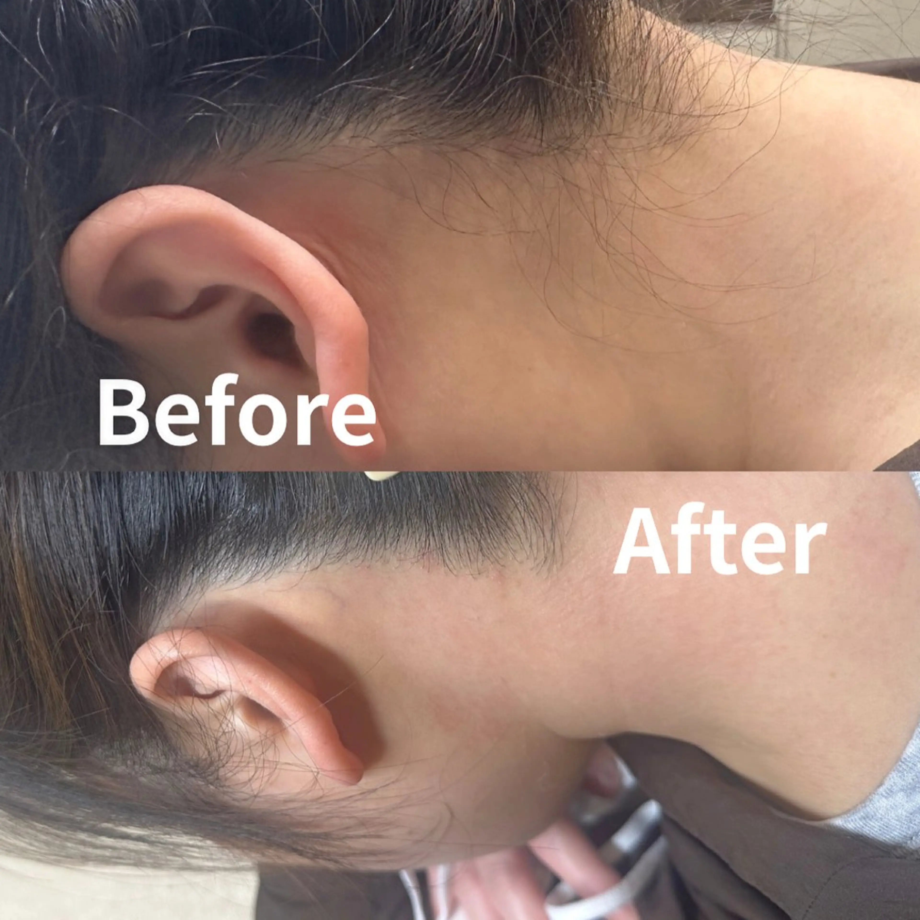 KOHOLA -ワックス脱毛専門-のエステ・リラクイメージ