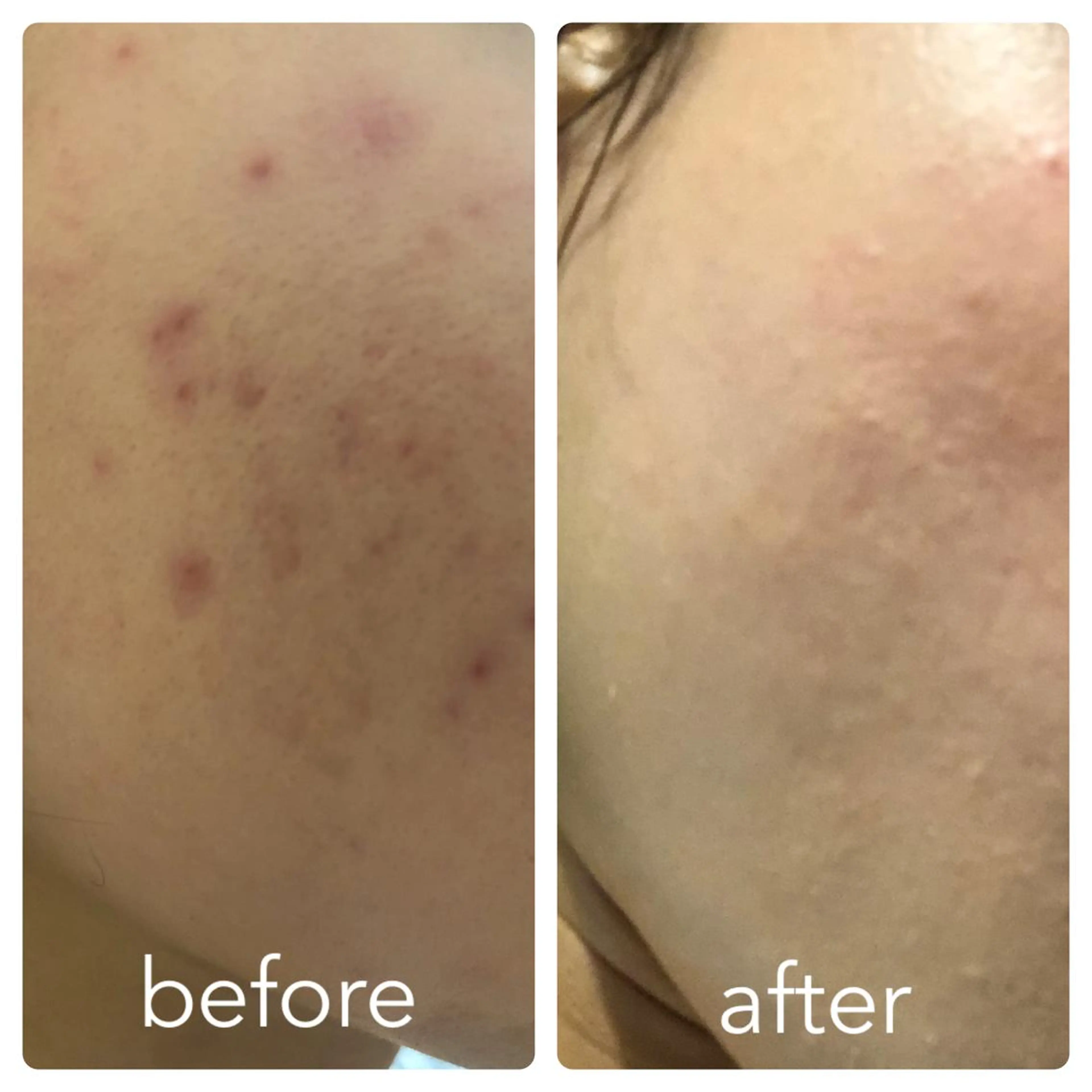 ナリス ビューティスタジオ De I'm所属・新田 彩乃のエステ・リラクイメージ