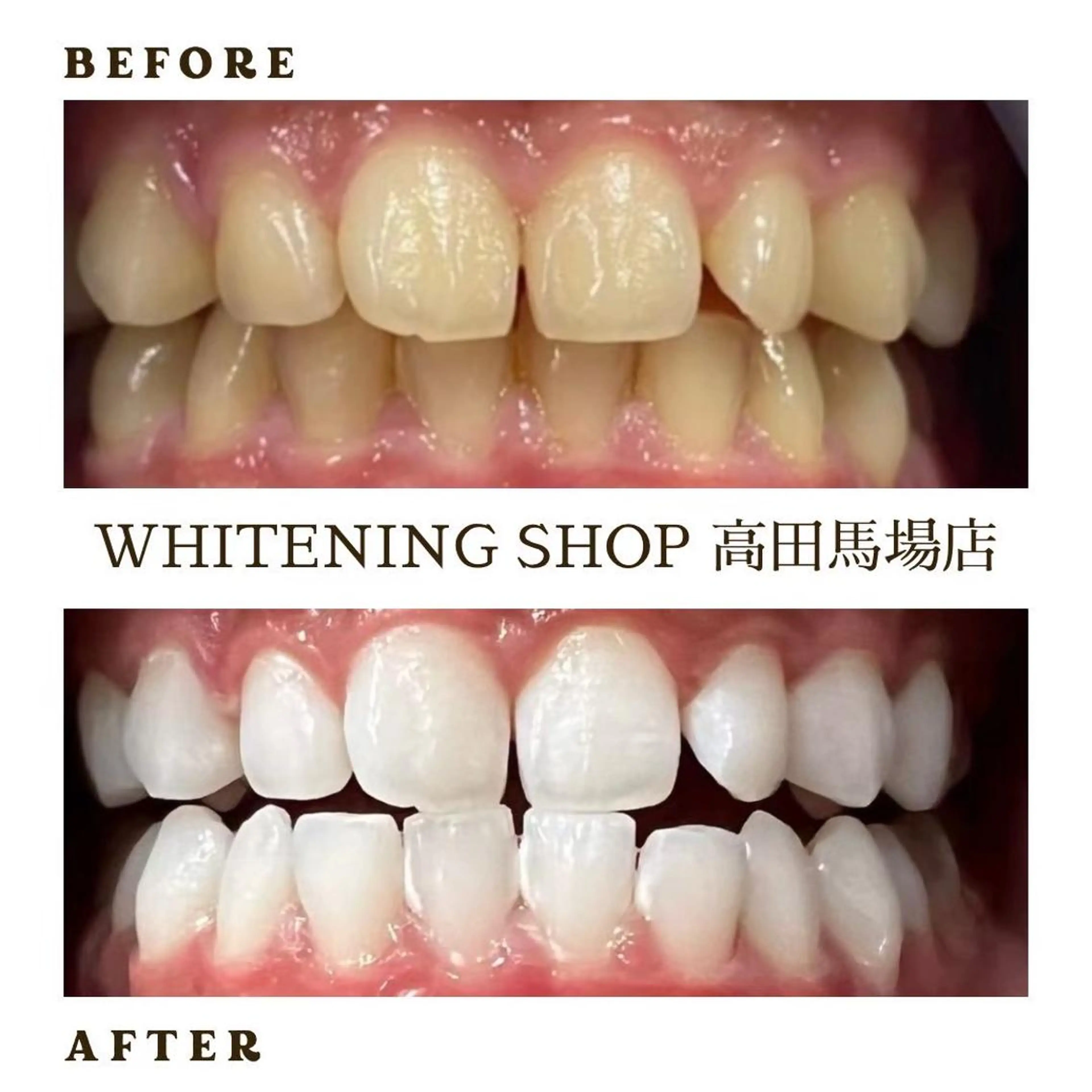 メンズ ホワイトニング ショップ高田馬場店のその他イメージ