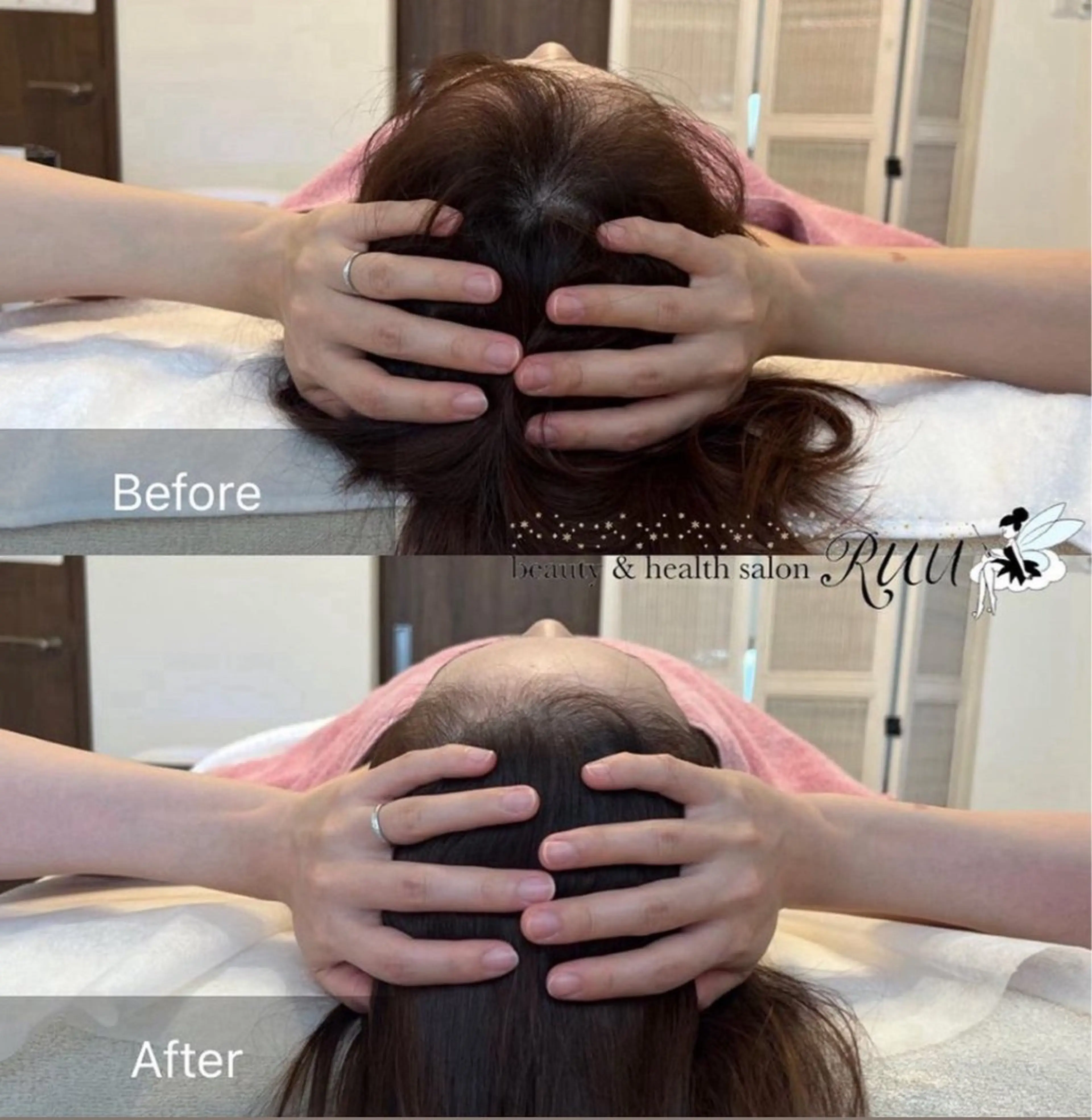 リラク 【頭痛、睡眠改善】 salon RUUのエステ・リラクイメージ