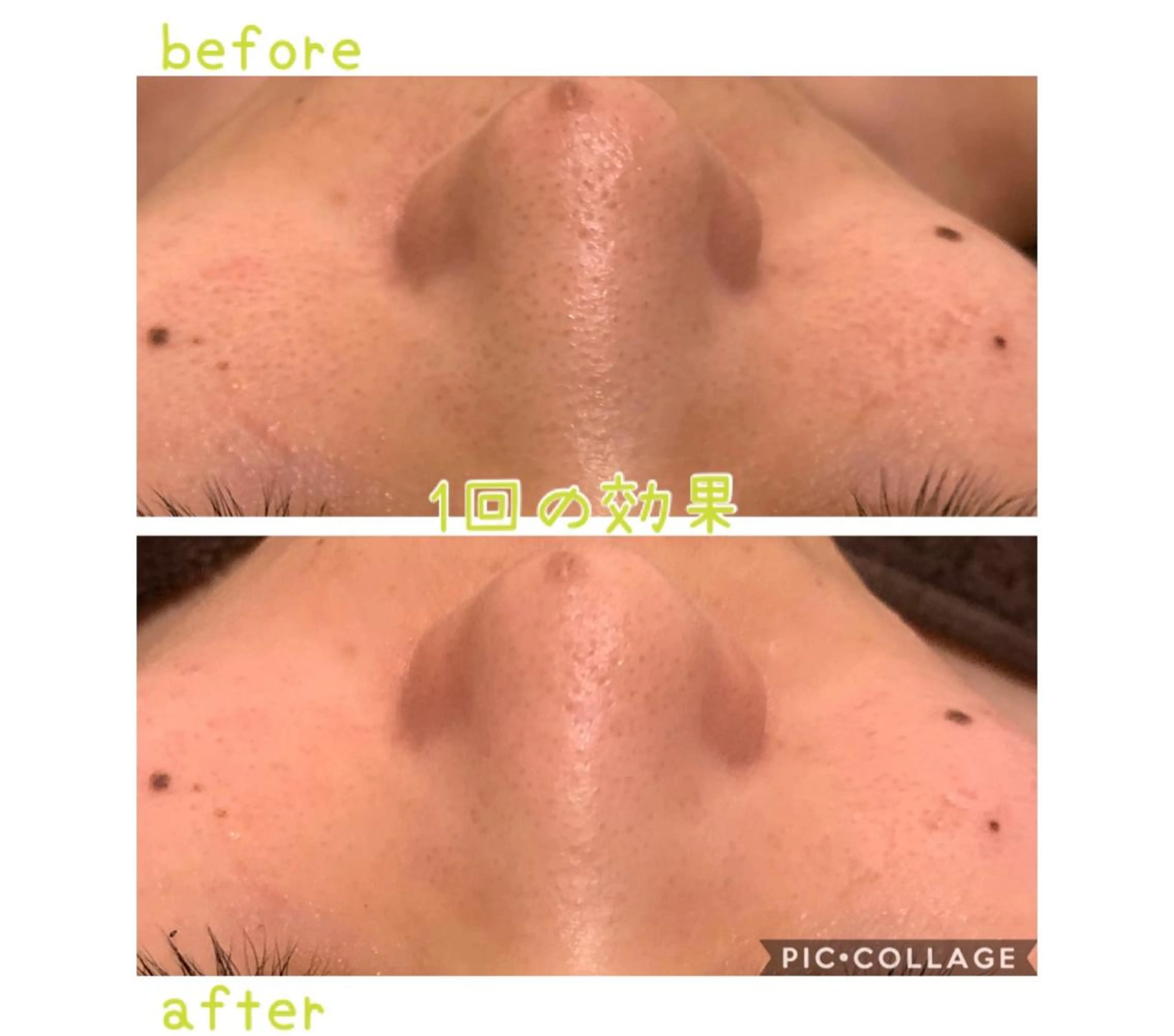 エステ 癒し腸もみサロン シャユーム　ゆきなのエステ・リラクイメージ