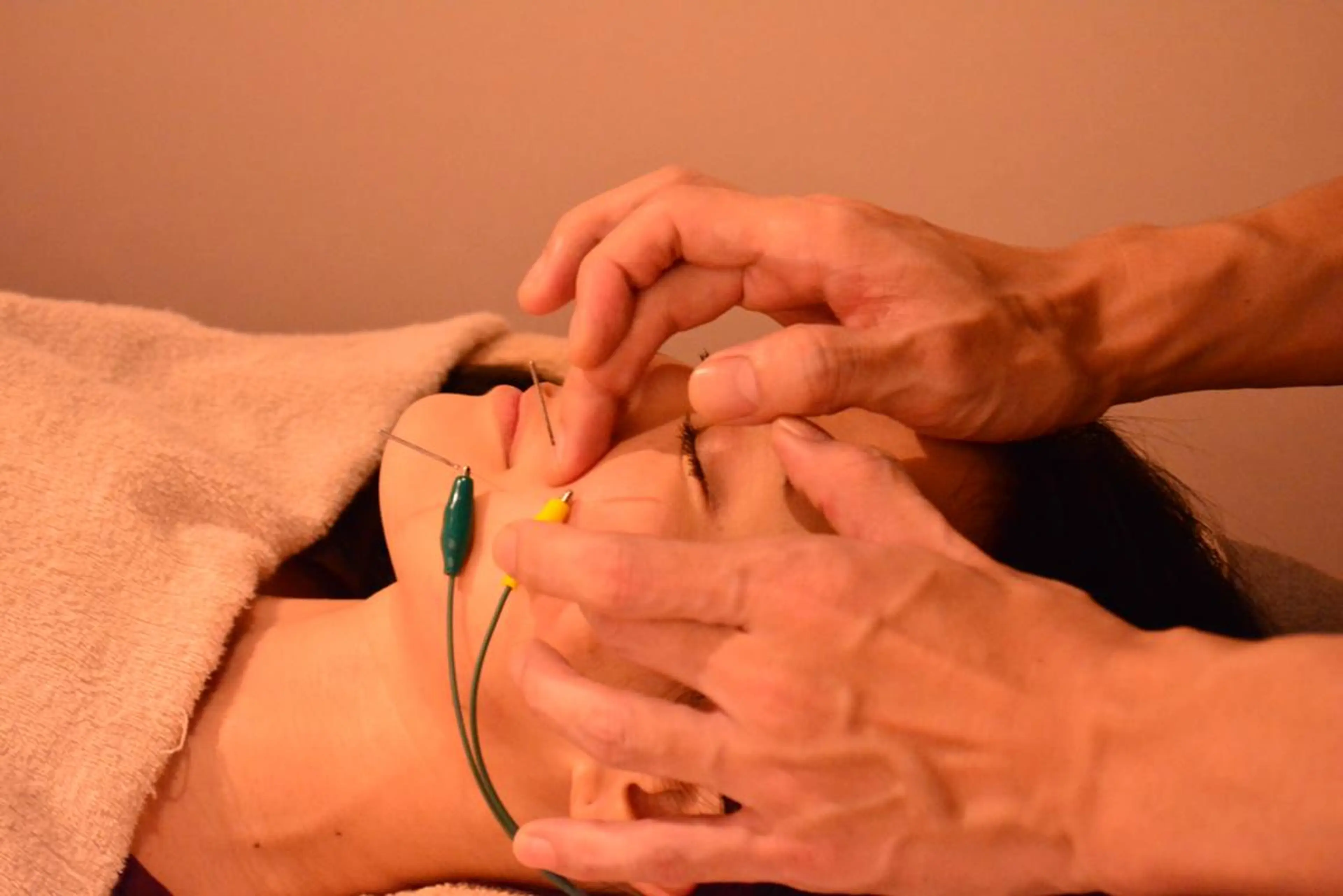 ✨minino限定コース✨気になるあのメニューをご案内✨電流美肌鍼～低周波で輝く肌へ～の写真