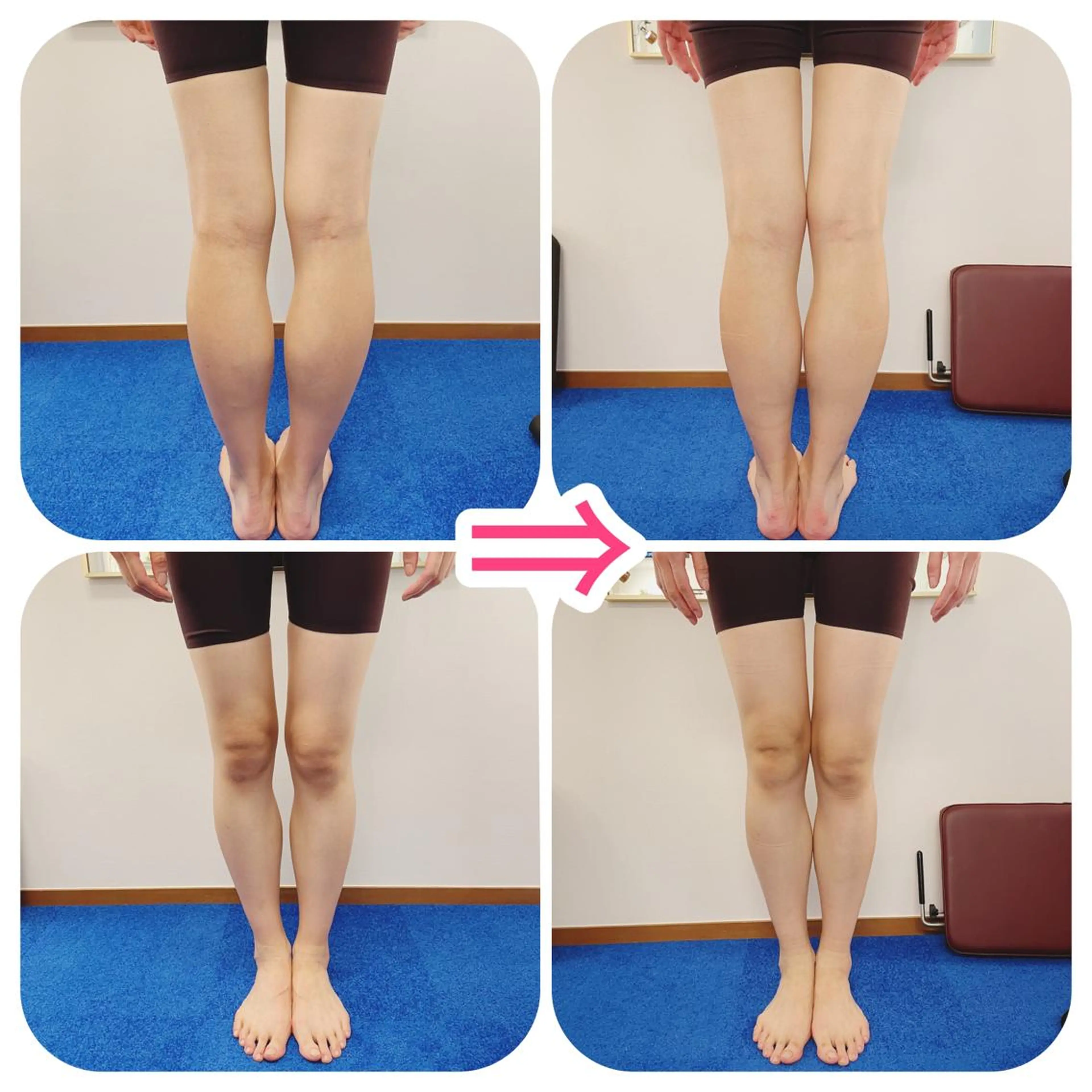 リラク 小顔美容鍼専門サロン 渋谷YZのその他イメージ