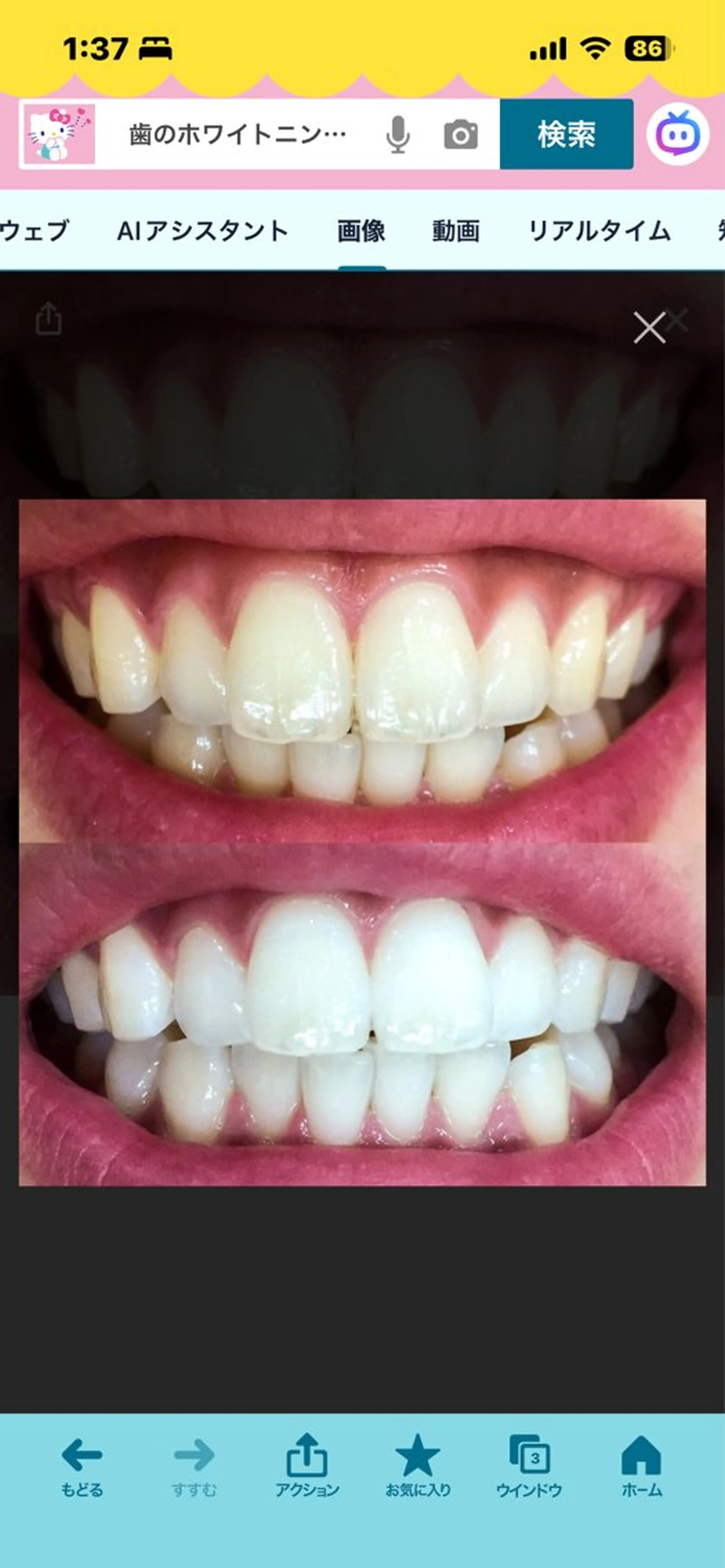 WHITENING ハウスのマツエク・マツパデザイン