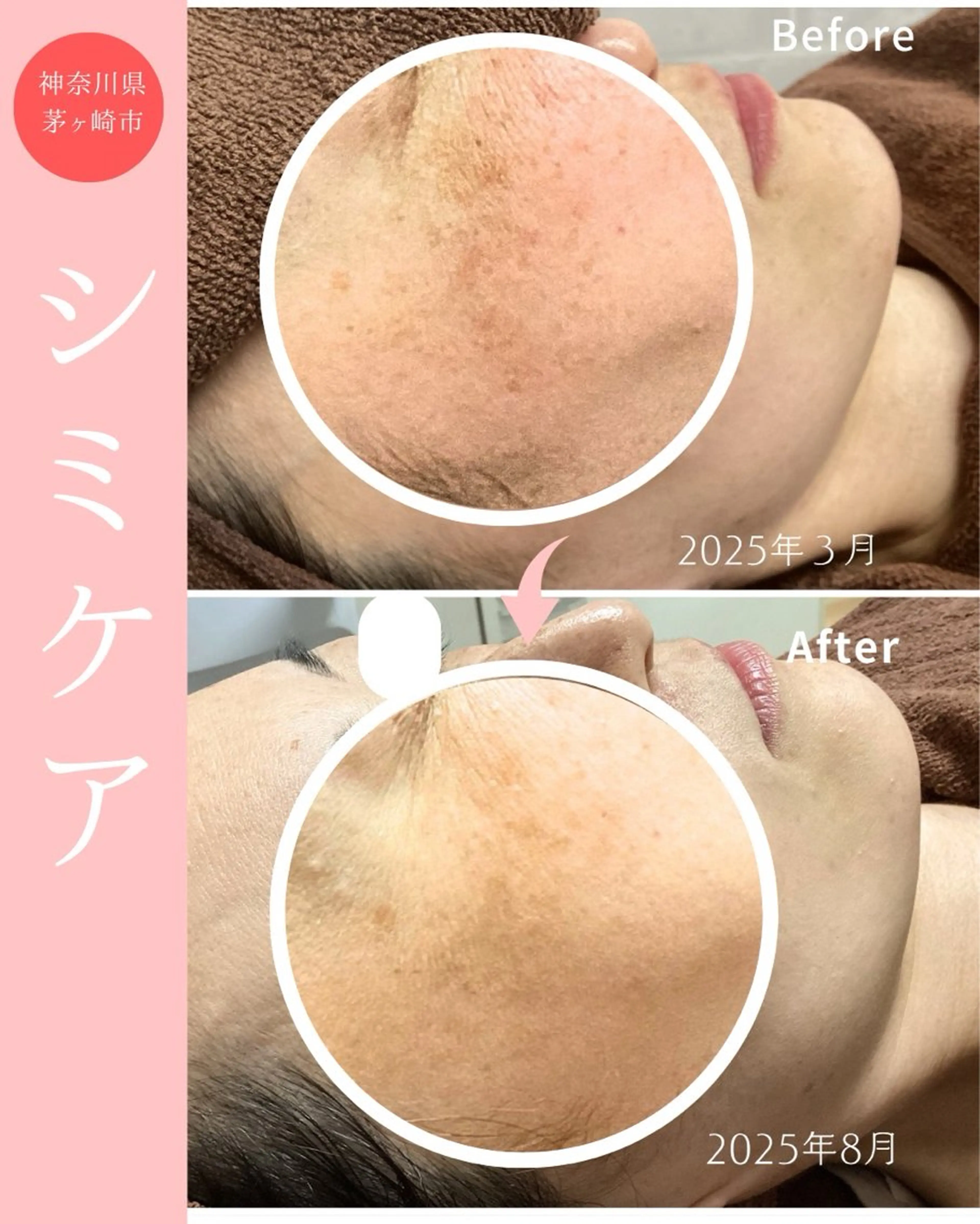 シミケア専科 Babyfaceのエステ・リラクイメージ