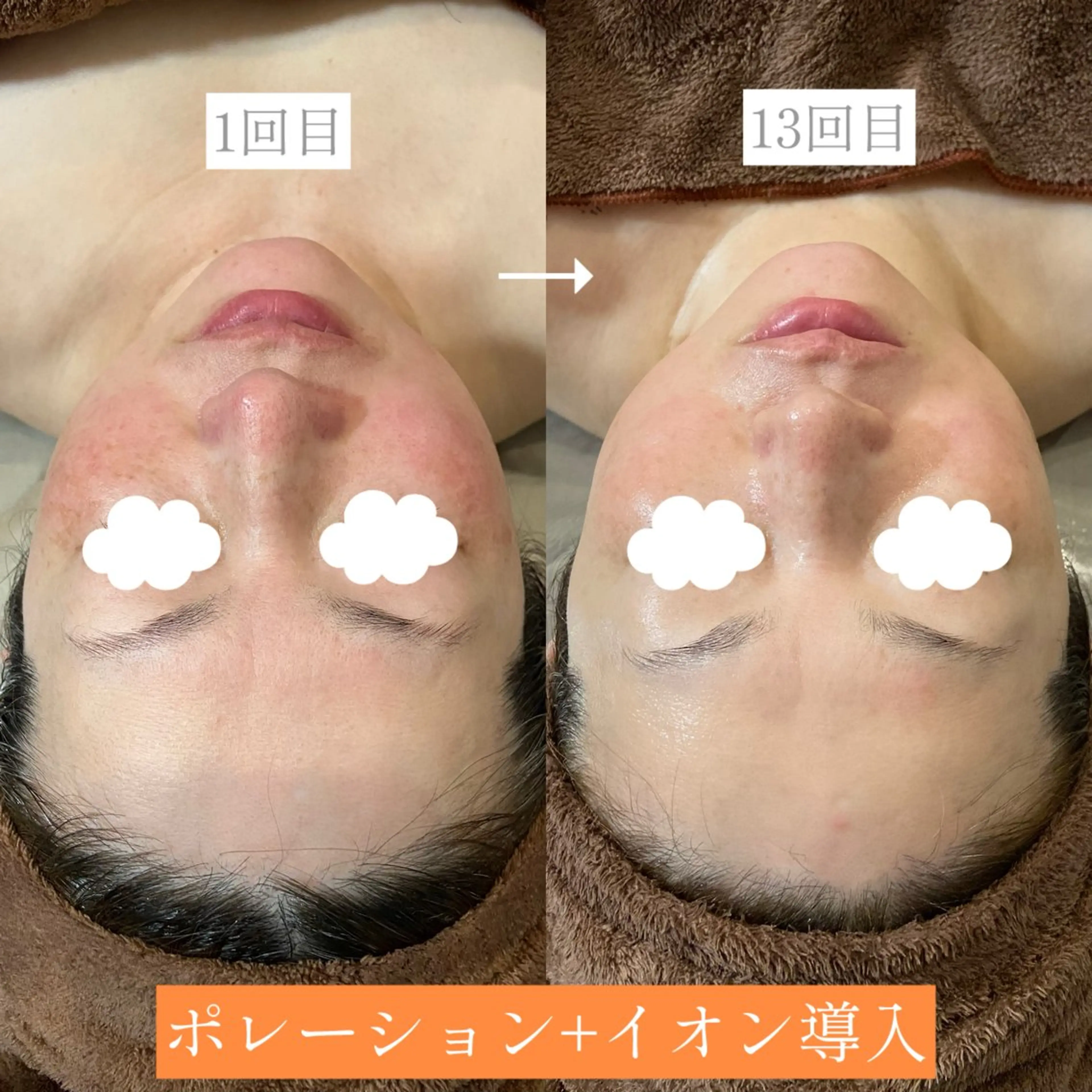 【Folche 春日店】馬場・大内田のエステ・リラクイメージ