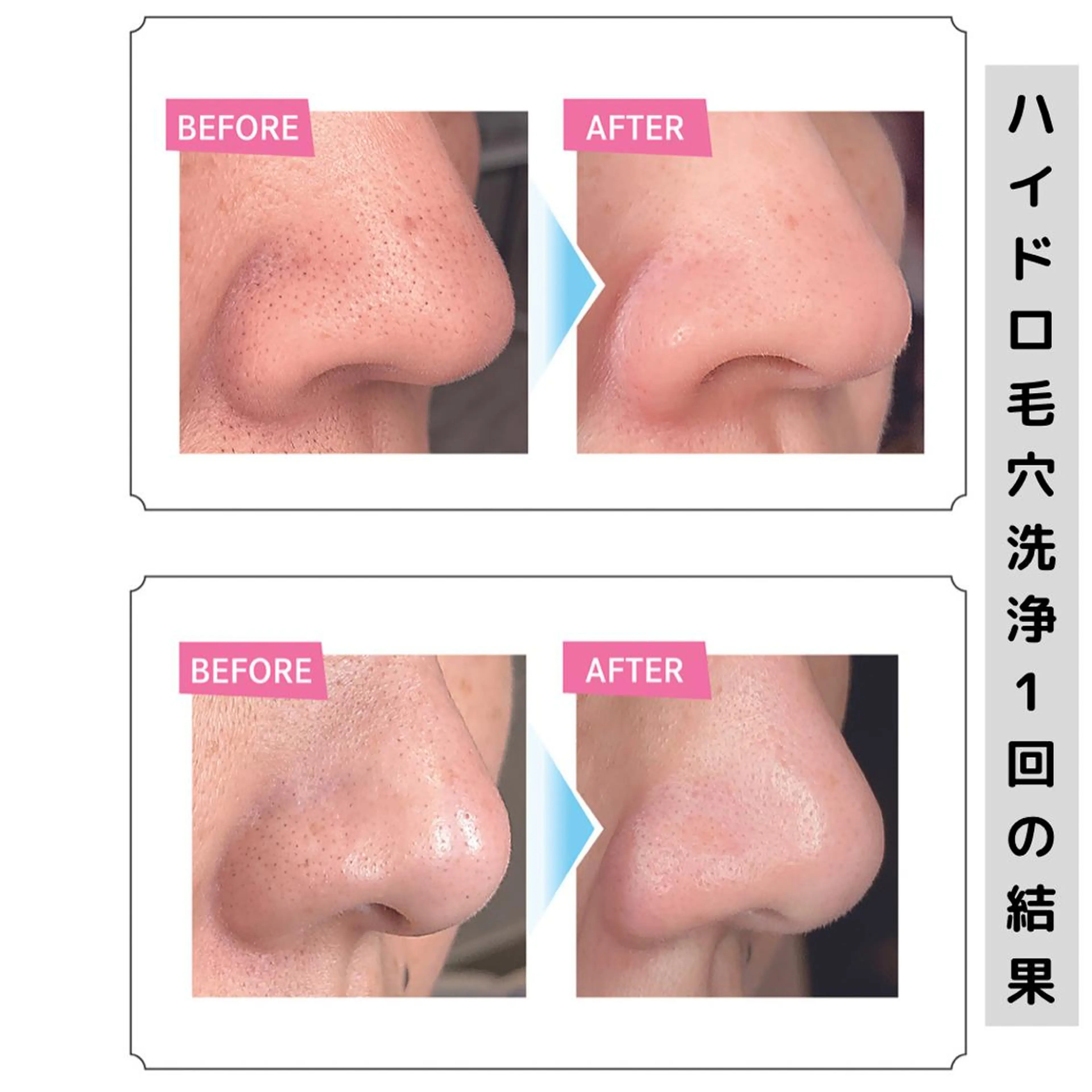 毛穴と美肌 littleroomのエステ・リラクイメージ