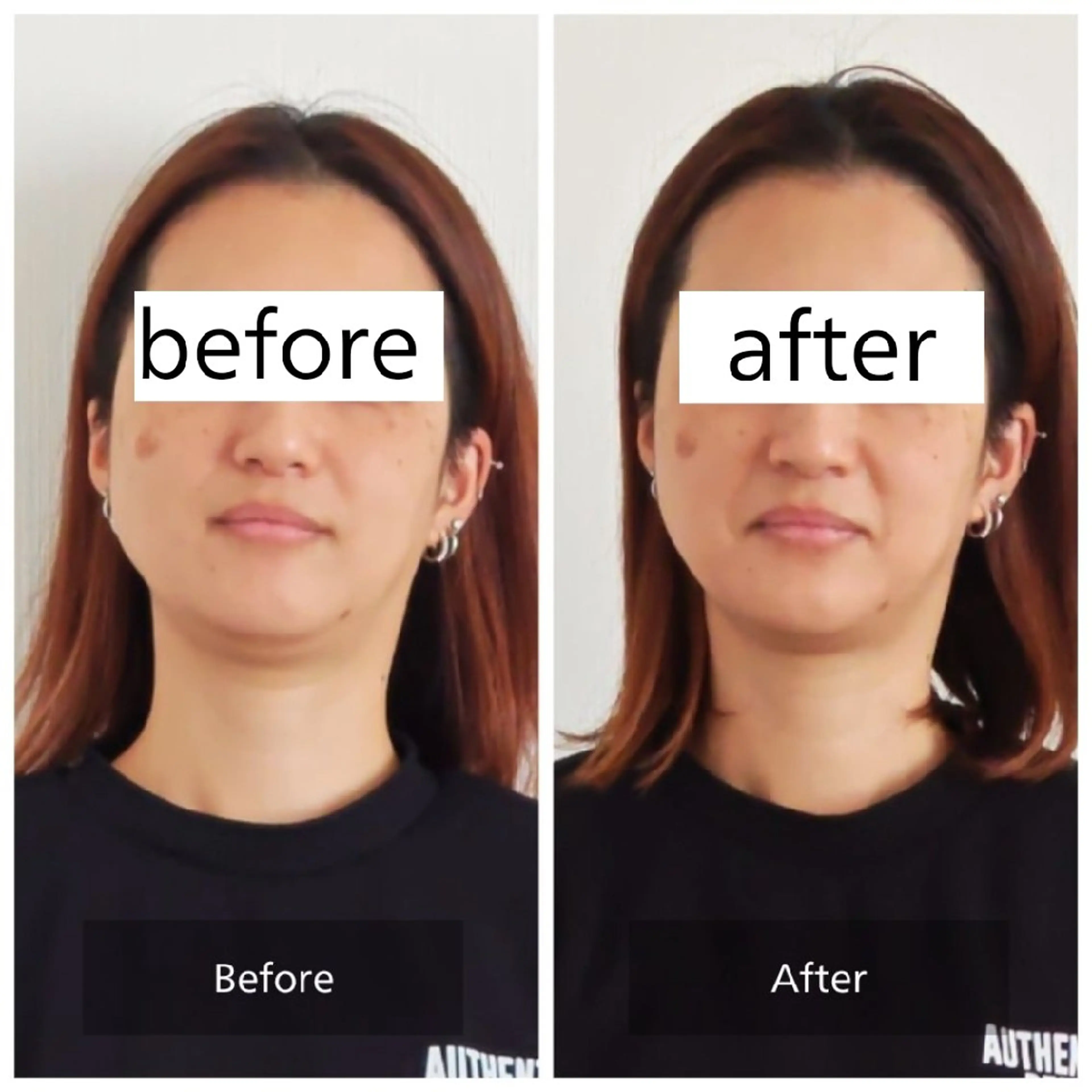 エステ リラク 桜井市｜小顔・ 美容矯正 madoiのエステ・リラクイメージ