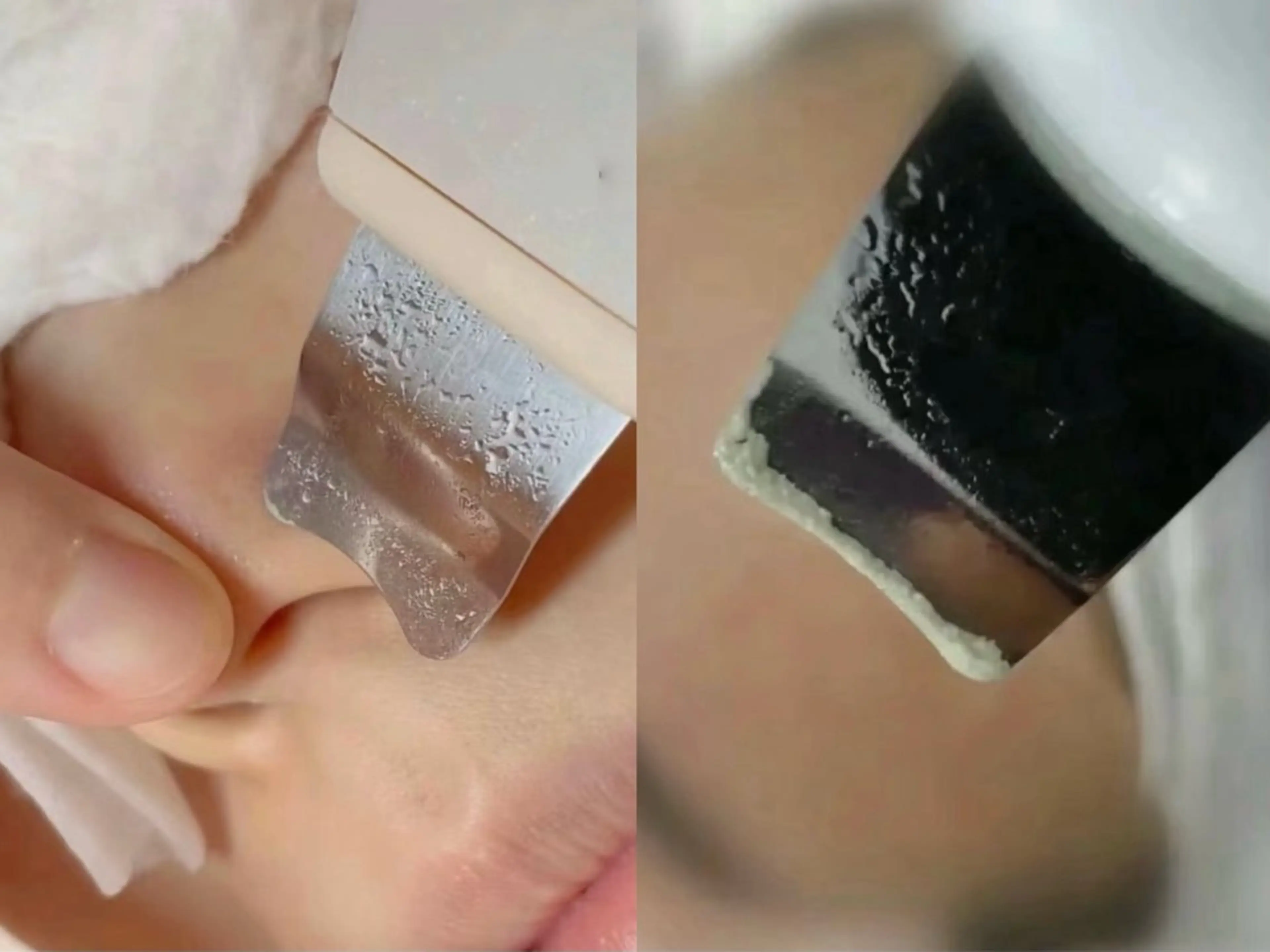 エステ 韓国式肌管理＆毛穴洗浄　THE ONE栄店所属・Theone 福本のエステ・リラクイメージ