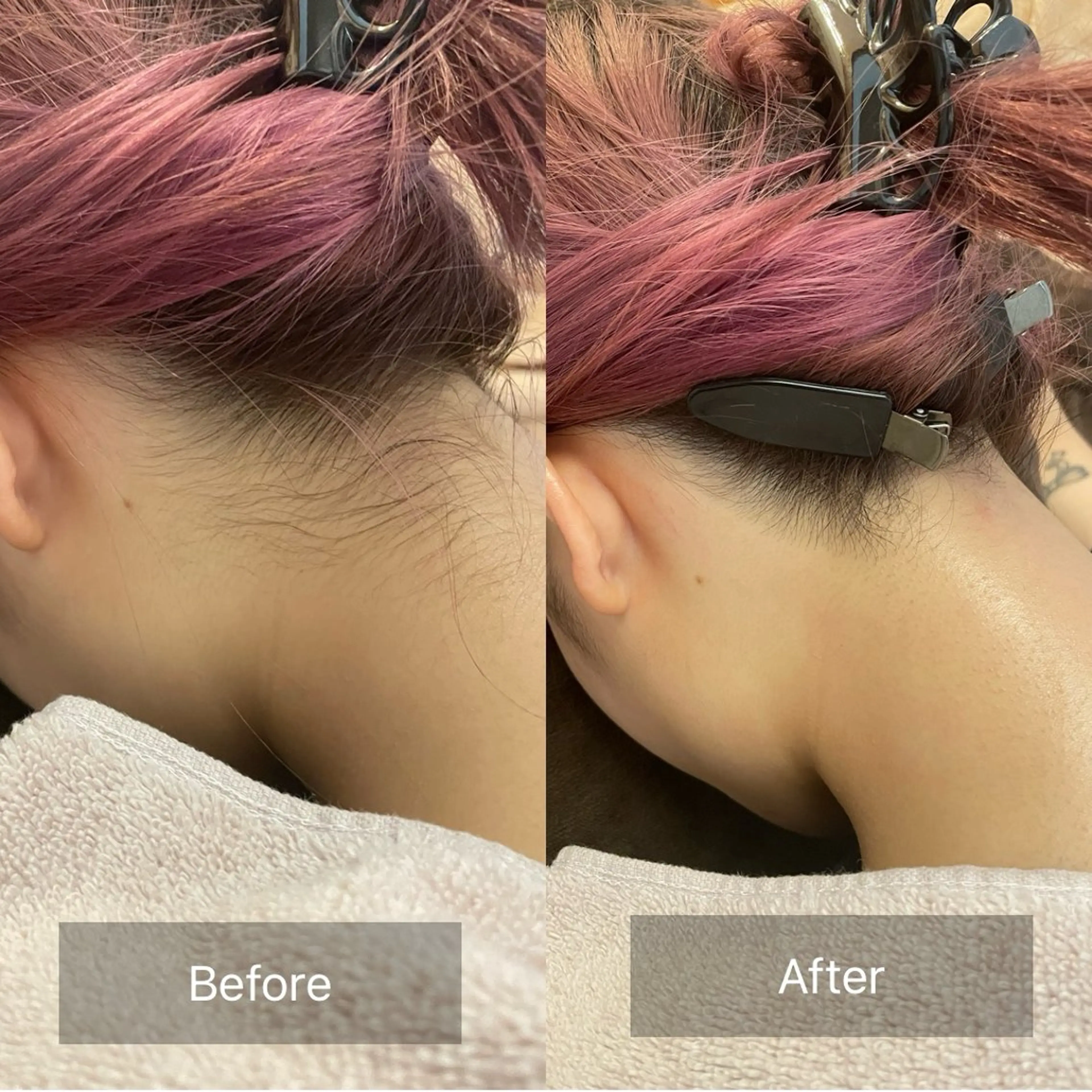 脱毛 宮崎 みおのエステ・リラクイメージ