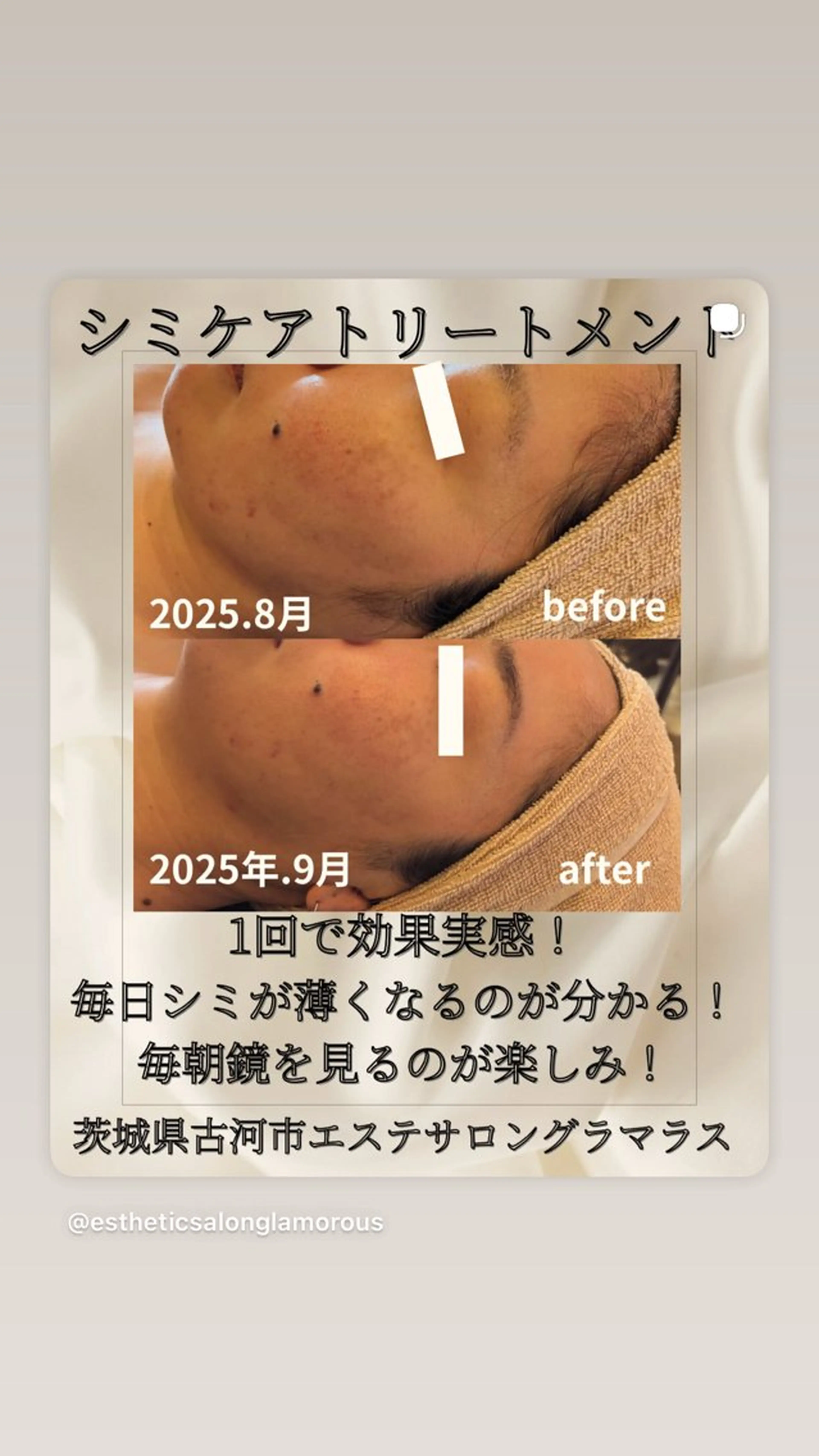 エステ エステサロン グラマラスのエステ・リラクイメージ