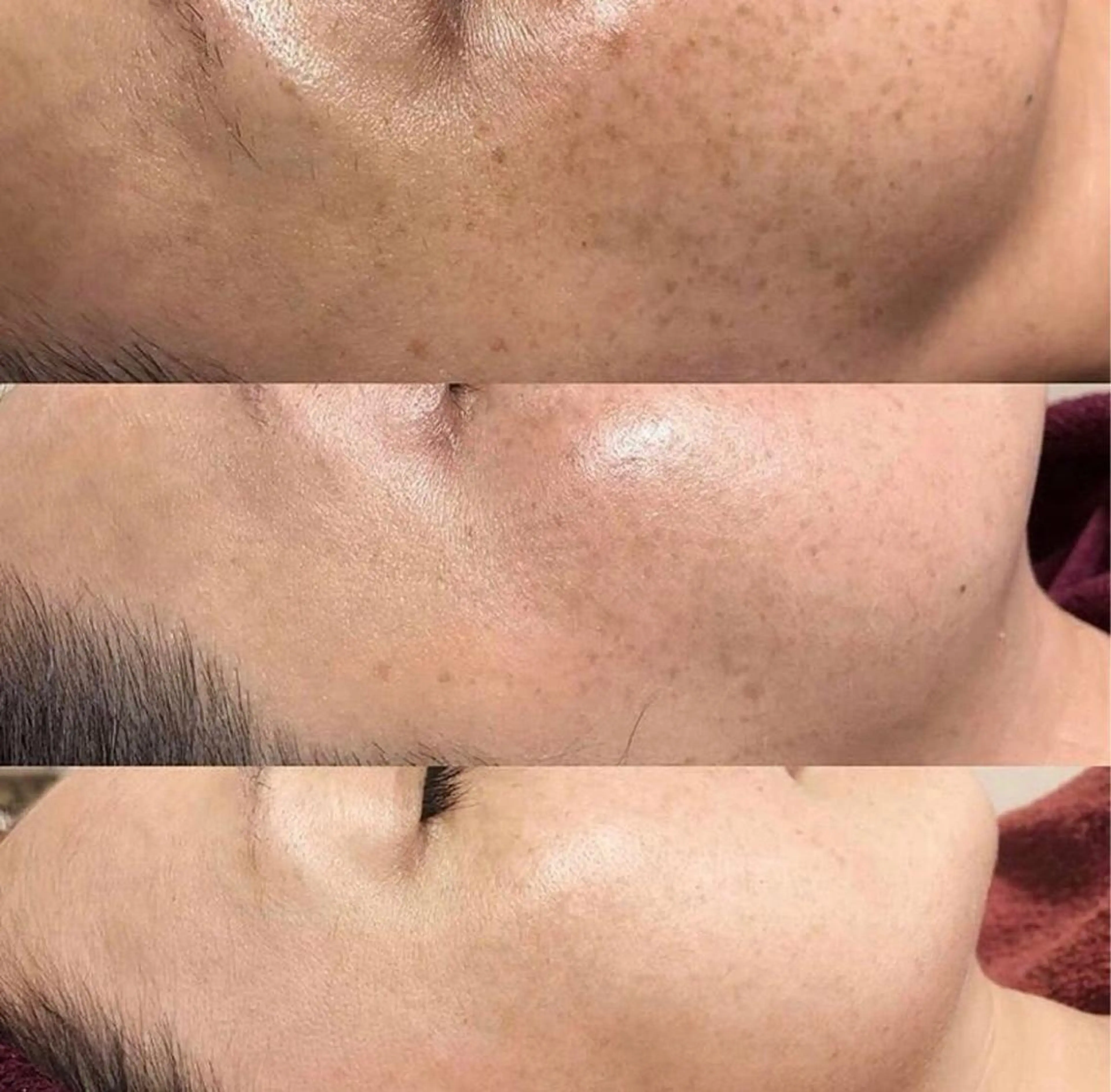 L’Beige レベージュのエステ・リラクイメージ